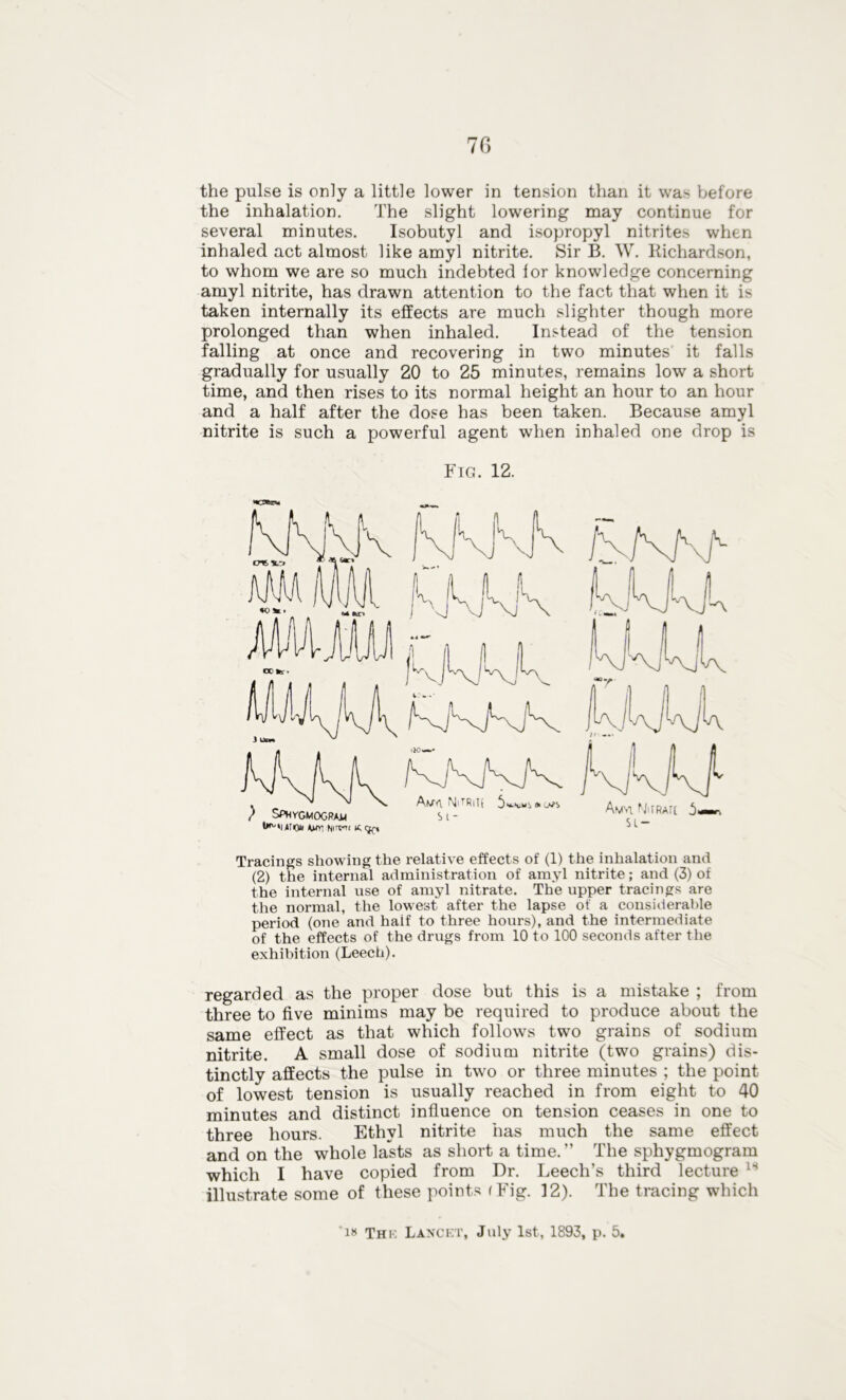 the pulse is only a little lower in tension than it was before the inhalation. The slight lowering may continue for several minutes. Isobutyl and isopropyl nitrites when inhaled act almost like amyl nitrite. Sir B. W. Kichardson, to whom we are so much indebted lor knowledge concerning amyl nitrite, has drawn attention to the fact that when it is taken internally its effects are much slighter though more prolonged than when inhaled. Instead of the tension falling at once and recovering in two minutes it falls gradually for usually 20 to 25 minutes, remains low a short time, and then rises to its normal height an hour to an hour and a half after the dose has been taken. Because amyl nitrite is such a powerful agent when inhaled one drop is Fig. 12. t^'unou tom Nirvm it, (Jf, Tracings showing the relative effects of (1) the inhalation and (2) the internal administration of amyl nitrite; and (3) of the internal use of amyl nitrate. The upper tracings are the normal, the lowest after the lapse of a considerable period (one and half to three hours), and the intermediate of the effects of the drugs from 10 to 100 seconds after the exhibition (Leech). regarded as the proper dose but this is a mistake ; from three to five minims may be required to produce about the same effect as that which follows two grains of sodium nitrite. A small dose of sodium nitrite (two grains) dis- tinctly affects the pulse in two or three minutes ; the point of lowest tension is usually reached in from eight to 40 minutes and distinct influence on tension ceases in one to three hours. Ethyl nitrite has much the same effect and on the whole lasts as short a time.” The sphygmogram which I have copied from Dr. Leech’s third lecture ls illustrate some of these points (Fig. 12). The tracing which