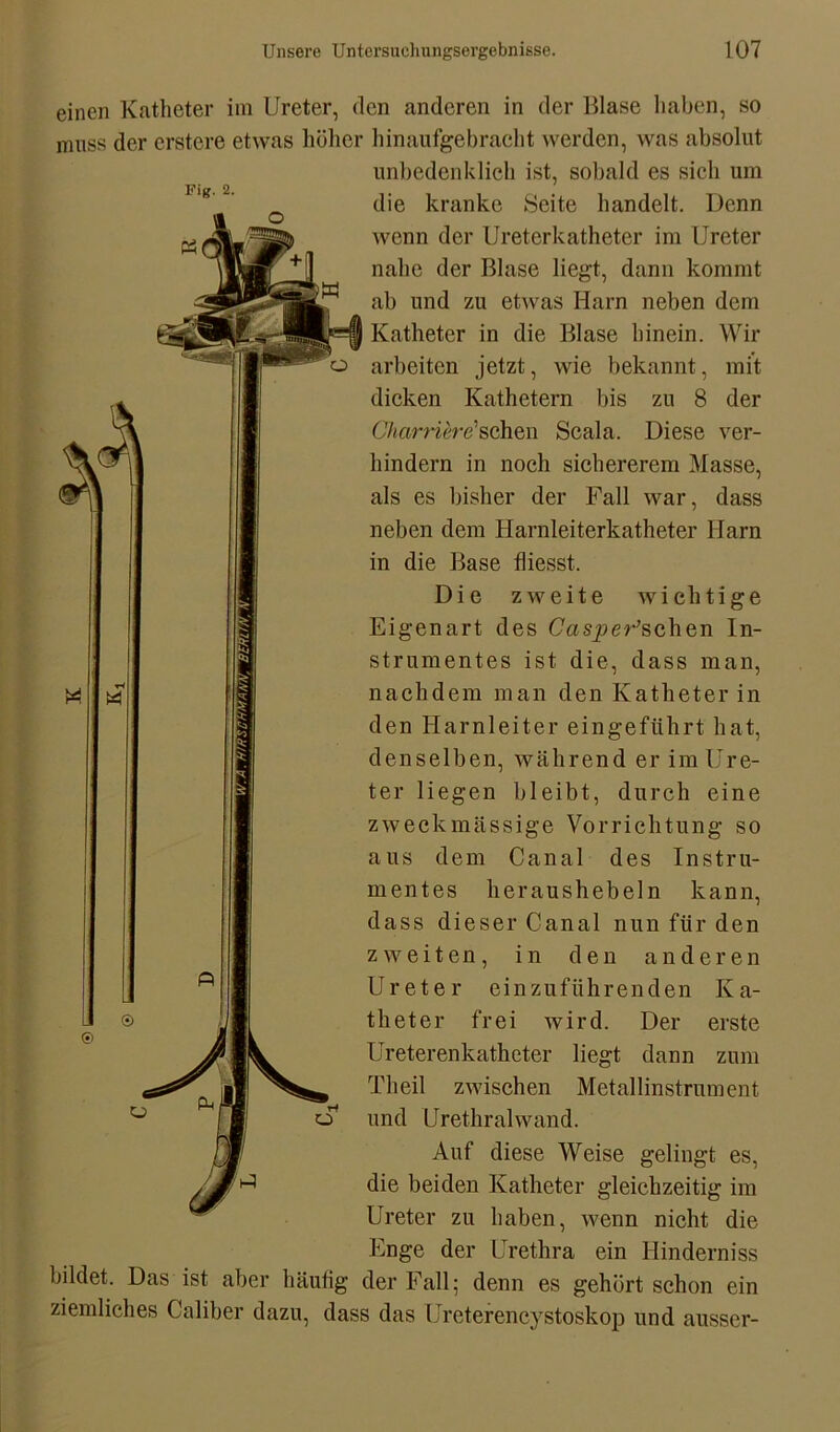 Fig. 2. einen Katheter im Ureter, den anderen in der Blase haben, so muss der erstere etwas höher hinaufgebracht werden, was absolut unbedenklich ist, sobald es sich um die kranke Seite handelt. Denn wenn der Ureterkatheter im Ureter nahe der Blase liegt, dann kommt ab und zu etwas Harn neben dem Katheter in die Blase hinein. Wir arbeiten jetzt, wie bekannt, mit dicken Kathetern bis zu 8 der Charriere'sehen Scala. Diese ver- hindern in noch sichererem Masse, als es bisher der Fall war, dass neben dem Harnleiterkatheter Harn in die Base fliesst. Die zweite wichtige Eigenart des Casper’sehen In- strumentes ist die, dass man, nachdem man den Katheter in den Harnleiter eingeführt hat, denselben, während er im Ure- ter liegen bleibt, durch eine zweckmässige Vorrichtung so aus dem Canal des Instru- mentes heraushebeln kann, dass dieser Canal nun für den zweiten, in den anderen Ureter einzuführenden Ka- theter frei wird. Der erste Ureterenkatheter liegt dann zum Theil zwischen Metallinstrument und Urethral wand. Auf diese Weise gelingt es, die beiden Katheter gleichzeitig im Ureter zu haben, wenn nicht die Enge der Urethra ein Hinderniss bildet. Das ist aber häuüg der Fall; denn es gehört schon ein ziemliches Caliber dazu, dass das Ureterencystoskop und ausser-