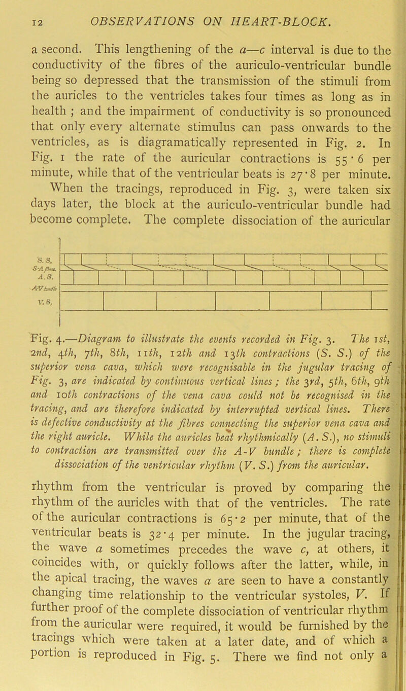 a second. This lengthening of the a—c interval is due to the conductivity of the fibres of the auriculo-ventricular bundle being so depressed that the transmission of the stimuli from the auricles to the ventricles takes four times as long as in health ; and the impairment of conductivity is so pronounced that only every alternate stimulus can pass onwards to the ventricles, as is diagramatically represented in Fig. 2. In Fig. 1 the rate of the auricular contractions is 55 • 6 per minute, while that of the ventricular beats is 27 -8 per minute. When the tracings, reproduced in Fig. 3, were taken six days later, the block at the auriculo-ventricular bundle had become complete. The complete dissociation of the auricular Fig. 4.—Diagram to illustrate the events recorded in Fig. 3. The 1st, 2nd, \th, yth, 8th, 11th, 12th and 13th contractions (S. S.) of the superior vena cava, which were recognisable in the jugular tracing of Fig. 3) arc indicated by continuous vertical lines ; the 3rd, 5th, 6th, 9tli and 10th contractions of the vena cava could not be recognised in the tracing, and are therefore indicated by interrupted vertical lines. There is defective conductivity at the fibres connecting the superior vena cava and the right auricle. While the auricles beat rhythmically (A. S.), no stimuli to contraction are transmitted over the A-V bundle; there is complete dissociation of the ventricular rhythm (V. S.) from the auricular. rhythm from the ventricular is proved by comparing the rhythm of the auricles with that of the ventricles. The rate of the auricular contractions is 65*2 per minute, that of the ventricular beats is 32-4 per minute. In the jugular tracing, the wave a sometimes precedes the wave c, at others, it coincides with, or quickly follows after the latter, while, in the apical tracing, the waves a are seen to have a constantly changing time relationship to the ventricular systoles, V. If further proof of the complete dissociation of ventricular rhythm fi om the auricular were required, it would be furnished by the tiacings which were taken at a later date, and of which a poition is reproduced in Fig. 5. There we find not only a