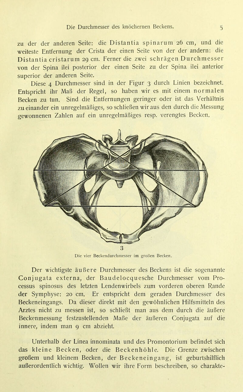Die Durchmesser des knöchernen Beckens. zu der der anderen Seite: die Distantia spinarum 26 cm, und die weiteste Entfernung der Crista der einen Seite von der der andern: die Distantia cristarum 29 cm. Ferner die zwei schrägen Durchmesser von der Spina ilei posterior der einen Seite zu der Spina ilei anterior superior der anderen Seite. Diese 4 Durchmesser sind in der Figur 3 durch Linien bezeichnet. Entspricht ihr Maß der Regel, so haben wir es mit einem normalen Becken zu tun. Sind die Entfernungen geringer oder ist das Verhältnis zueinander ein unregelmäßiges, so schließen wir aus den durch die Messung gewonnenen Zahlen auf ein unregelmäßiges resp. verengtes Becken. 3 Die vier Beckendurchmesser im großen Becken. Der wichtigste äußere Durchmesser des Beckens ist die sogenannte Conjugata externa, der Baudelocquesche Durchmesser vom Pro- cessus spinosus des letzten Lendenwirbels zum vorderen oberen Rande der Symphyse: 20 cm. Er entspricht dem geraden Durchmesser des Beckeneingangs. Da dieser direkt mit den gewöhnlichen Hilfsmitteln des Arztes nicht zu messen ist, so schließt man aus dem durch die äußere Beckenmessung festzustellenden Maße der äußeren Conjugata auf die innere, indem man 9 cm abzieht. Unterhalb der Linea innominata und des Promontorium befindet sich das kleine Becken, oder die Beckenhöhle. Die Grenze zwischen großem und kleinem Becken, der Beckeneingang, ist geburtshilflich außerordentlich wichtig. Wollen wir ihre Form beschreiben, so charakte-