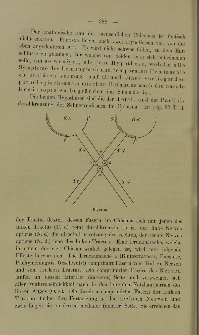 Der anatomische Bau des meneclilichen Chiasmas ist faetiech meht erkannt. Faetiscl, liefen auch .wei Hypothesen vor, vo de^^ eben angedeuteten Art. Es wird nicht schwer fallen, .u dem E„t- scMusse zu gelangen, für welche von beiden man sich entscheiden solle, um so weniger, als jene Hypothese, welche alle Symptome der homonymen und temporalen Hemianopio zu erklären vermag, auf Grund eines vorliegenden pathologisch.anatomischen Befundes auch die nasale liemianopie zu begründen im Stande ist. Die beiden Hypothesen sind die der Total- und der Partial durchfaeuzung der Sehnervenfasern im Chiasma. Ist Fig 22 T d Figur 22. der Tractus dexter, dessen Fasern im Chiasma sich mit jenen des linken Tractus (T. s.) total durchkreuzen, so ist der linke Nervus opticus (N. s.) die directe Fortsetzung des rechten, der rechte Nervus opticus (N. d.) jene des linken Tractus. Eine Druckursache, welche in einem der vier Chiasmawinkel gelegen ist, wird nun folgende Effecte hervorrufen. Die Druckursache a (Blutextravasat, Exostose, Pachymeningitis, Geschwulst) comprimirt Fasern vom linken Nerven und vom linken Tractus. Die comprimirten Fasern des Nerven laufen an dessen lateraler (äusserer) Seite und verzweigen sich aller Wahrscheinlichkeit nach in den lateralen Netzhautpartien des linken Auges (0. s.). Die durch a comprimirten Fasern des linken Tractus finden ihre Fortsetzung in den rechten Nerven und zwar liegen sie an dessen medialer (innerer) Seite. Sie erreichen das