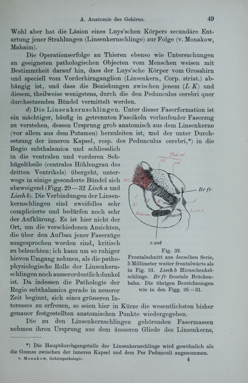 Thcd.crpt Wohl aber hat die Läsion eines Luys’schen Körpers secundäre Ent- artung jener Strahlungen (Linsenkernschlinge) zur Folge (v. Monakow, Mahaim). Die Operationserfolge an Thieren ebenso wie Untersuchungen an geeigneten pathologischen Objecten vom Menschen weisen mit Bestimmtheit darauf hin, dass der Luys’sche Körper vom Grosshirn und speciell vom Vorderhirnganglion (Linsenkern, Corp. striat.) ab- hängig ist, und dass die Beziehungen zwischen jenem [L K) und diesem, theilweise wenigstens, durch die den Pedunculus cerebri quer durchsetzenden Bündel vermittelt werden. d) Die Linsenkernschlingen. Unter dieser Faserformation ist ein mächtiger, häufig in getrennten Fascikeln verlaufender Faserzug zu verstehen, dessen Ursprung grob anatomisch aus dem Linsenkerne (vor allem aus demPutamen) herzuleiten ist, und der unter Durch- setzung der inneren Kapsel, resp. des Pedunculus cerebri,*) in die Kegio subthalamica und schliesslich in die ventralen und vorderen Seh- hügeltheile (centrales Höhlengrau des .M dritten Ventrikels) übergeht, unter- wegs in einige gesonderte Bündel sich pyL. abzweigend (Figg. 29 — 32 Lisch a und Lisch b). Die Verbindungen der Linsen- kernschlingen sind zweifellos sehr complicierte und bedürfen noch sehr der Aufklärung. Es ist hier nicht der Ort, um die verschiedenen Ansichten, die über den Aufbau jener Faserzüge ausgesprochen worden sind, kritisch zu beleuchten; ich kann um so ruhiger hievon Umgang nehmen, als diepatho- physiologische Kolle der Linsenkern- schlingen noch ausserordentlich dunkel ist. Da indessen die Pathologie der Regio subthalamica gerade in neuerer Zeit beginnt, sich eines grösseren In- teresses zu erfreuen, so seien hier in Kürze die wesentlichsten bisher genauer festgestellten anatomischen Punkte wiedergegeben. Die zu den Linsenkernschlingen gehörenden Fasermassen nehmen ihren Ursprung aus dem äusseren Gliede des Linsenkerns, Br fr Lisch b c ant Fig. 32. Frontalschnitt aus derselben Serie,. 5 Millimeter weiter frontalwärts als in Fig. 31. Lisch b Hirnschenkel- schlinge. Br fr frontale Brücken- bahn. Die übrigen Bezeichnungen wie in den Figg. 26 — 31. *) Die Hauptdurchgangstelle der Linsenkernschlinge wird gewöhnlich als die Grenze zwischen der inneren Kapsel und dem Pes Pedunculi angenommen, v. Monakow, Gehirnpathologie. 4