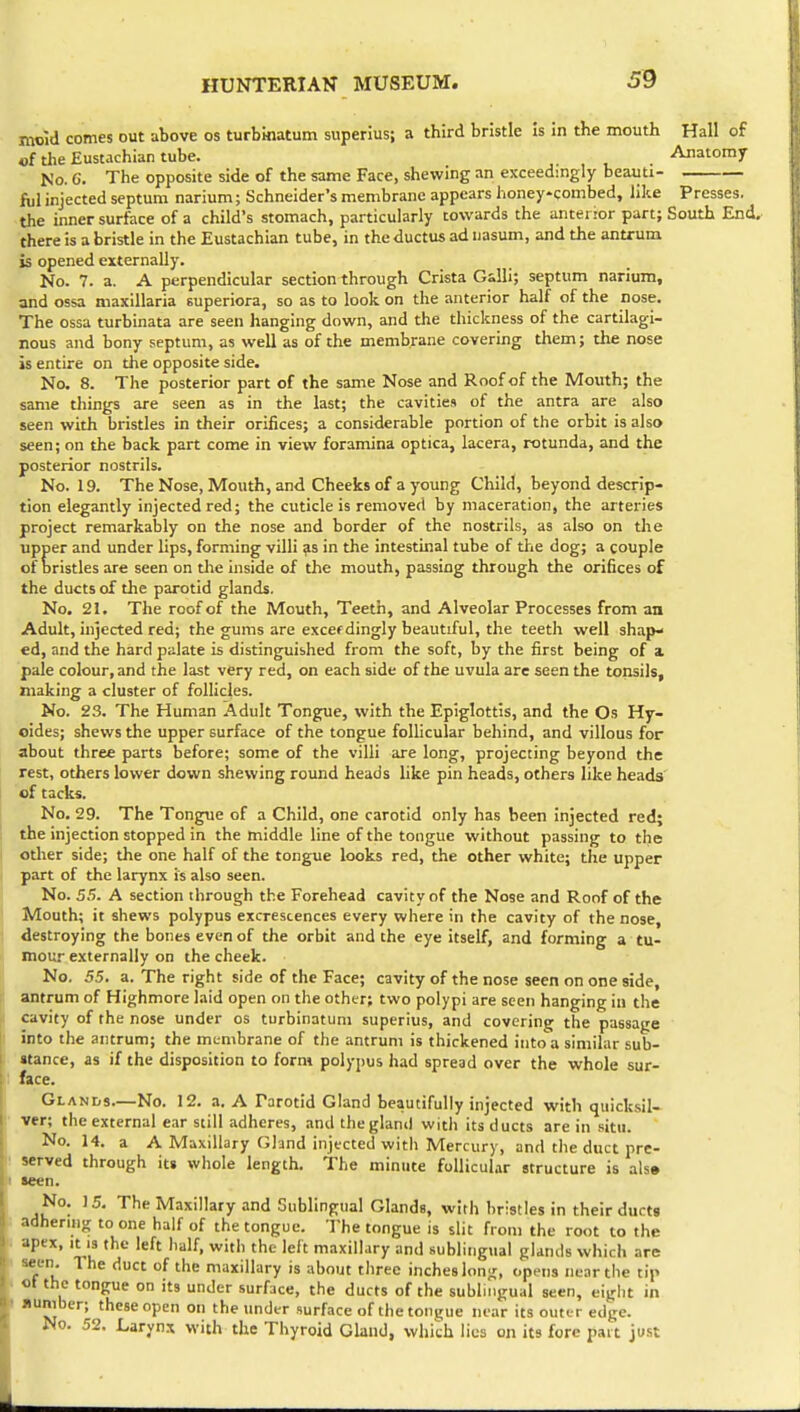 mold comes out above os turbkiatum superius; a third bristle is in the mouth Hall of of the Eustachian tube. ,. , , . No. C. The opposite side of the same Face, shewing an exceedingly beauti- ftjl injected septum narium; Schneider's membrane appears honey-combed, like Presses, the inner surface of a child's stomach, particularly towards the anterior part; South End, there is a bristle in the Eustachian tube, in the ductus ad nasum, and the antrum is opened externally. No. 7. a. A perpendicular section through Crista GiUi; septum narium, and ossa maxillaria superiora, so as to look on the anterior half of the nose. The ossa turbinata are seen hanging down, and the thickness of the cartilagi- nous and bony septum, as well as of the membrane covering them; the nose is entire on the opposite side. No. 8. The posterior part of the same Nose and Roof of the Mouth; the same things are seen as in the last; the cavities of the antra are also seen with bristles in their orifices; a considerable portion of the orbit is also seen; on the back part come in view foramina optica, lacera, rotunda, and the posterior nostrils. No. 19. The Nose, Mouth, and Cheeks of a young Child, beyond descrip- tion elegantly injected red; the cuticle is removed by maceration, the arteries project remarkably on the nose and border of the nostrils, as also on the upper and under lips, forming villi ?s in the intestinal tube of the dog; a couple of bristles are seen on the inside of the mouth, passing through the orifices of the ducts of the parotid glands. No. 21. The roof of the Mouth, Teeth, and Alveolar Processes from an Adult, injected red; the gums are excef dingly beautiful, the teeth well shap- ed, and the hard palate is distinguished from the soft, by the first being of a pale colour, and the last very red, on each side of the uvula are seen the tonsils, making a cluster of follicles. No. 23. The Human Adult Tongue, with the Epiglottis, and the Os Hy- oides; shews the upper surface of the tongue follicular behind, and villous for about three parts before; some of the villi are long, projecting beyond the rest, others lower down shewing round heads like pin heads, others like heads' of tacks. No. 29. The Tongue of a Child, one carotid only has been injected red; the injection stopped in the middle line of the tongue without passing to the other side; the one half of the tongue looks red, the other white; the upper part of the larynx is also seen. No. 55. A section through the Forehead cavity of the Nose and Roof of the Mouth; it shews polypus excrescences every where in the cavity of the nose, destroying the bones even of the orbit and the eye itself, and forming a tu- mour externally on the cheek. No. ,55. a. The right side of the Face; cavity of the nose seen on one side, antrum of Highmore laid open on the other; two polypi are seen hanging in the cavity of the nose under os turbinatum superius, and covering the passage into the antrum; the membrane of the antrum is thickened into a similar sub- stance, as if the disposition to form polypus had spread over the whole sur- face. Glands—No. 12. a. A Parotid Gland beautifully injected with quicksil- ver; the external ear still adheres, and theglaml with its ducts are in situ. No. 14. a A Maxillary Gland injected with Mercury, and the duct pre- served through its whole length, the minute follicular structure is alse seen. No. 15. The Maxillary and Sublingual Glands, with bristles in their ducts adhering to one half of the tongue. The tongue is slit from the root to the are P apex, It 13 the left half, with the left maxillary and sublingual glands which ar seen. The duct of the maxillary is about three inches long, opens near the ti ot the tongue on its under surface, the ducts of the sublingual seen, eight i number; these open on the under surface of the tongue near its outer edge. No. 52. Laryns with the Thyroid Gland, which lies on its fore part just