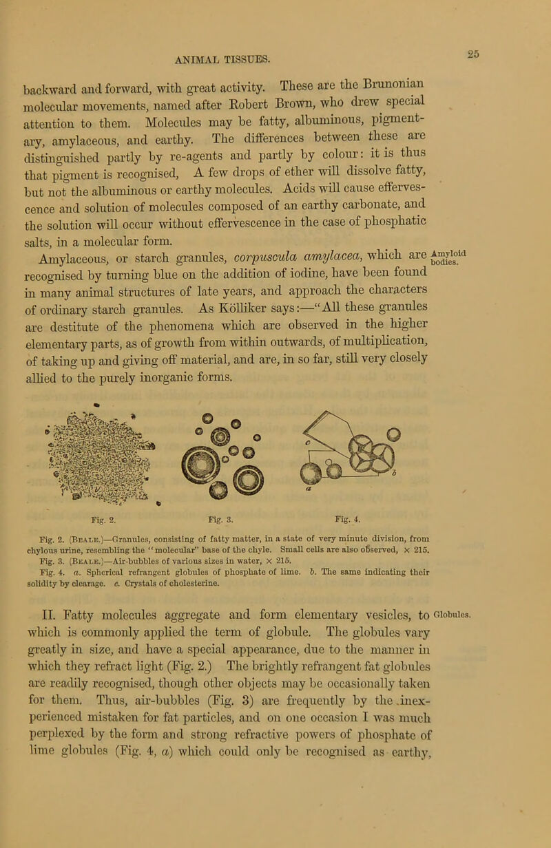 backward and forward, with, great activity. These are the Brunonian molecular movements, named after Robert Brown, who drew special attention to them. Molecules may be fatty, albuminous, pigment- ary, amylaceous, and earthy. The differences between these are distinguished partly by re-agents and partly by colour: it is thus that pigment is recognised, A few drops of ether will dissolve fatty, but not the albuminous or earthy molecules. Acids will cause efferves- cence and solution of molecules composed of an earthy carbonate, and the solution will occur without effervescence in the case of phosphatic salts, in a molecular form. Amylaceous, or starch granules, corpuscula amylacea, which are ^o“?e1soi<1 recognised by turning blue on the addition of iodine, have been found in many animal structures of late years, and approach the characters of ordinary starch granules. As Kolliker says:—“ All these granules are destitute of the phenomena which are observed in the higher elementary parts, as of growth from within outwards, of multiplication, of taking up and giving off material, and are, in so far, still very closely allied to the purely inorganic forms. Fig. 2. (Beale.)—Granules, consisting of fatty matter, in a state of very minute division, from chylous urine, resembling the “molecular” base of the chyle. Small cells are also observed, x 215. Fig. 3. (Beale.)—Air-bubbles of various sizes in water, x 215. Fig. 4. a. Spherical refrangent globules of phosphate of lime. b. The same indicating their solidity by dearage. c. Crystals of cholesterine. II. Ratty molecules aggregate and form elementary vesicles, to Globules, which is commonly applied the term of globule. The globules vary greatly in size, and have a special appearance, due to the manner in which they refract light (Fig. 2.) The brightly refrangent fat globules are readily recognised, though other objects may be occasionally taken for them. Thus, air-bubbles (Fig. 3) are frequently by the .inex- perienced mistaken for fat particles, and on one occasion I was much perplexed by the form and strong refractive powers of phosphate of lime globules (Fig. 4, a) which could only be recognised as earthy,