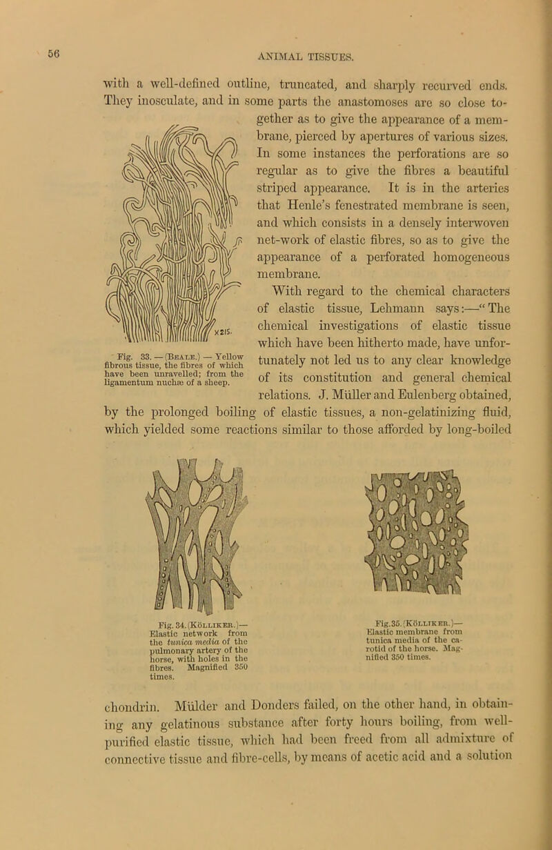 with a well-defined outline, truncated, and sharply recurved ends. They inosculate, and in some parts the anastomoses are so close to- gether as to give the appearance of a mem- brane, pierced by apertures of various sizes. In some instances the perforations are so regular as to give the fibres a beautiful striped appearance. It is in the arteries that Henle’s fenestrated membrane is seen, and which consists in a densely interwoven net-work of elastic fibres, so as to give the appearance of a perforated homogeneous membrane. With regard to the chemical characters of elastic tissue, Lehmann says:—“ The chemical investigations of elastic tissue which have been hitherto made, have unfor- tunately not led us to any clear knowledge of its constitution and general chemical relations. J. Muller and Eulenberg obtained, by the prolonged boiling of elastic tissues, a non-gelatinizing fluid, which yielded some reactions similar to those afforded by long-boiled Fig. 33. — (Beat.e.) — Yellow fibrous tissue, the fibres of which have been unravelled; from the ligamentum nucha: of a sheep. the tunica media of the pulmonary artery of the liorse, with holes in the fibres. Magnified 350 times. Fig.35.'K0LLIKEE.)— Elastic membrane from tunica media of the ca- rotid of the liorse. Mag- nified 350 times. chondrin. Mulder and Bonders failed, on the other hand, in obtain- ing any gelatinous substance after forty hours boiling, from well- purified elastic tissue, which had been freed from all admixture of connective tissue and fibre-cells, by means of acetic acid and a solution