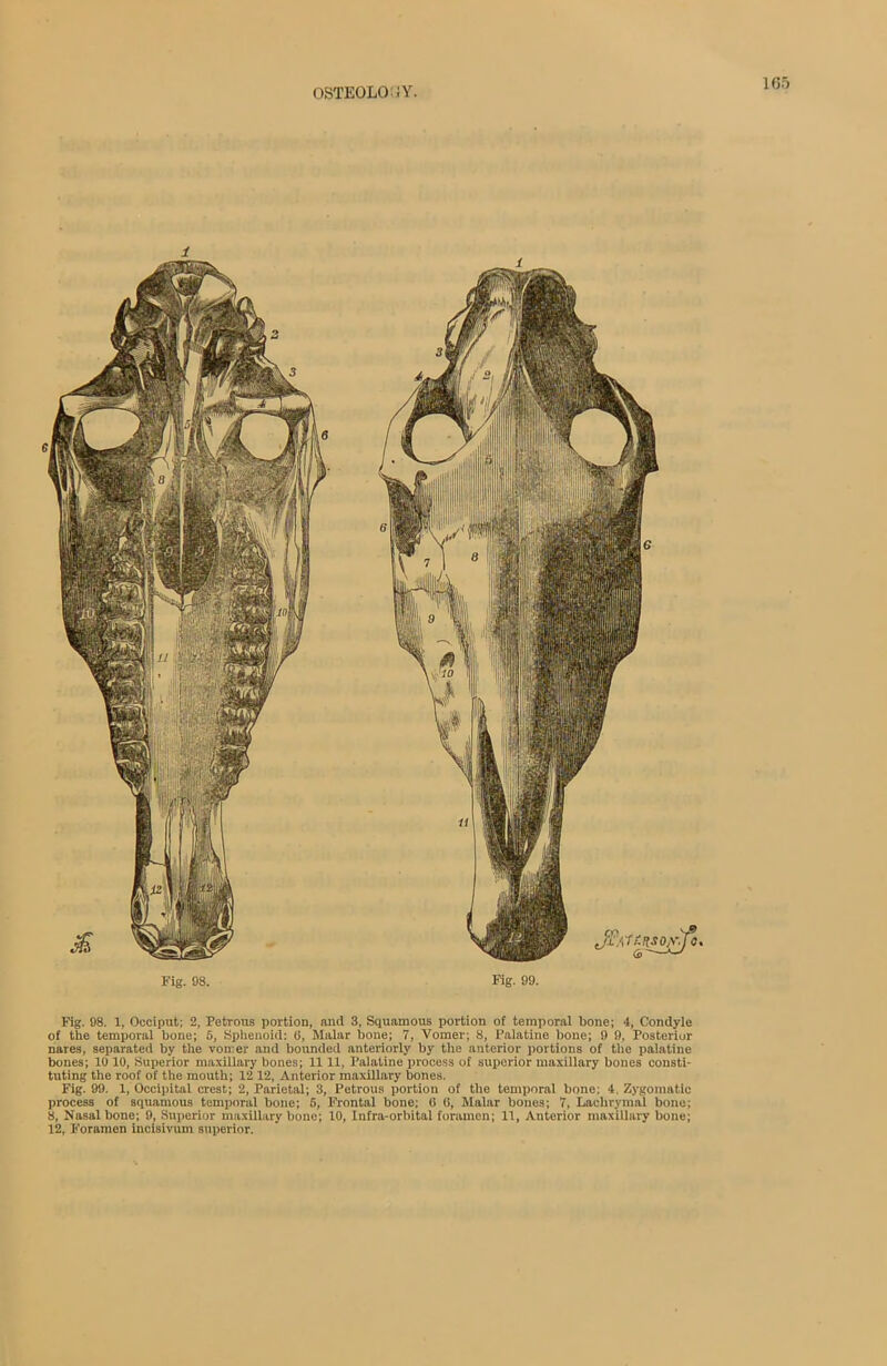 Fig. 98. Fig. 99. Fig. 98. 1, Occiput; 2, Petrous portion, and 3, Squamous portion of temporal bone; 4, Condyle of the temporal bone; 5, Sphenoid: 6, Malar bone; 7, Vomer; 8, Palatine bone; 9 9, Posterior nares, separated by the vomer and bounded anteriorly by the anterior portions of the palatine bones; 10 10, Superior maxillary bones; 11 11, Palatine process of superior maxillary bones consti- tuting the roof of the mouth; 12 12, Anterior maxillary bones. Fig. 99. 1, Occipital crest; 2, Parietal; 3, Petrous portion of the temporal bone; 4, Zygomatic process of squamous temporal bone; 5, Frontal bone; (i (i, Malar bones; 7, Lachrymal bone; 8, Nasal bone; 9, Superior maxillary bone; 10, Infra-orbital foramen; 11, Anterior maxillary bone; 12, Foramen incisivum superior.