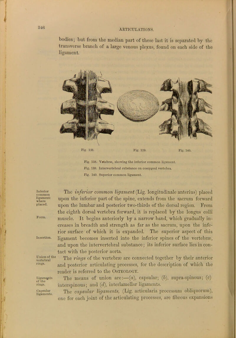 24(5 ARTICULATIONS. Inferior common ligament: where placed. Form. Insertion. Union of the vertebral rings. Ligaments of the rings. Capsular ligaments. bodies; but from the median part of these last it is separated by the transverse branch of a large venous plexus, found on each side of the ligament. Fig. 138. Fig. 139. Fig. 140. Fig. 138. Vetebrse, showing the inferior common ligament. Fig. 139. Intervertebral substance on coccygeal vertebra. Fig. 140. Superior common ligament. The inferior common ligament (Lig. longitudinale anterius) placed upon the inferior part of the spine, extends from the sacrum forward upon the lumbar and posterior two-thirds of the dorsal region. From the eighth dorsal vertebra forward, it is replaced by the longus colli muscle. It begins anteriorly by a narrow band, which gradually in- creases iu breadth and strength as far as the sacrum, upon the infe- rior surface of which it is expanded. The superior aspect of this ligament becomes inserted into the inferior spines of the vertebrae, and upon the intervertebral substance; its inferior surface lies in con- tact with the posterior aorta. The rings of the vertebrae are connected together by their anterior and posterior articulating processes, for the description of which the reader is referred to the Osteology. The means of union are:—(a), capsular; (b), supra-spinous; (c) iuterspinous; and (d), interlamellar ligaments. The capsular ligaments, (Lig. articularia procession obliquorum), one for each joint of the articulating processes, are fibrous expansions