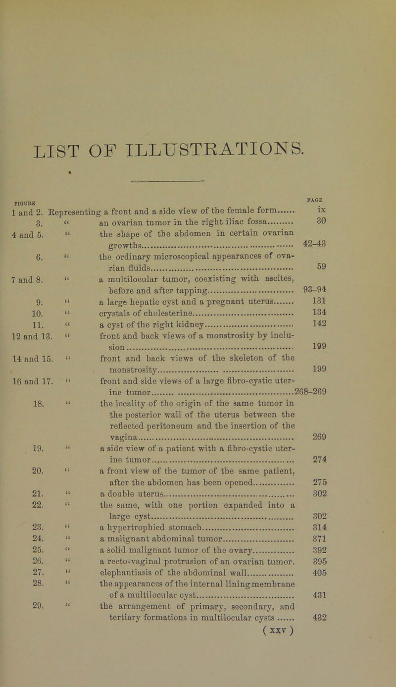 LIST OF ILLUSTRATIONS. FIGURE 1 and 2. 3. 4 and 6. 6. Representing a front and a side view of the female form “ an ovarian tumor in the right iliac fossa “ the shape of the abdomen in certain ovarian growths “ the ordinary microscopical appearances of ova- PAGE is 30 42-43 7 and 8. “ 9. “ 10. “ 11. “ 12 and 13.  14 and 15. “ 16 and 17. “ 18. “ rian fluids 59 a multilocular tumor, coexisting with ascites, before and after tapping 93-94 a large hepatic cyst and a pregnant uterus 131 crystals of cholesterine 134 a cyst of the right kidney 142 front and back views of a monstrosity by inclu- sion 199 front and back views of the skeleton of the monstrosity 199 front and side views of a large fibro-cystic uter- ine tumor 268-269 the locality of the origin of the same tumor in the posterior wall of the uterus between the reflected peritoneum and the insertion of the vagina 269 19. “ 20. “ 21. “ 22. 23. “ 24. “ 25. “ 26. “ 27. “ 28. “ 29. “ a side view of a patient with a flbro-cystic uter- ine tumor... 274 a front view of the tumor of the same patient, after the abdomen has been opened 275 a double uterus 302 the same, with one portion expanded into a large cyst 302 a hypertrophied stomach 314 a malignant abdominal tumor 371 a solid malignant tumor of the ovary 392 a recto-vaginal protrusion of an ovarian tumor. 395 elephantiasis of the abdominal wall 405 the appearances of the internal liningmembrane of a multilocular cyst 431 the arrangement of primary, secondary, and tertiary formations in multilocular cysts 432 (sxv)