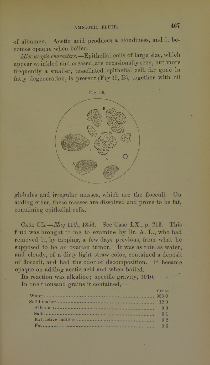 AMNIOTIC FLUID. of albumen. Acetic acid produces a cloudiness, and it be- comes opaque when boiled. 31icroscop7c characters.—Epithelial cells of large size, which appear wrinkled and creased, are occasionally seen, but more frequently a smaller, tessellated,epithelial cell, far gone in fatty degeneration, is present (Fig 39, B), together with oil Fig. 39. globules and irregular masses, which are the flocculi. On adding ether, these masses are dissolved and prove to be fat, containing epithelial cells. Case CL.—3Iay 11th., 1856. See Case LX., p. 213. This fluid was brought to me to examine by Dr. A. L., who had removed it, by tapping, a few days previous, from what he supposed to be an ovarian tumor. It was as thin as water, and cloudy, of a dirty light straw color, contained a deposit of flocculi, and had the odor of decomposition. It beoame opaque on adding acetic acid and when boiled. Its reaction was alkaline; specific gravity, 1010. In one thousand grains it contained,— Grains. Water 988 0 Solid matter 12 0 Albumen 3 0 Salts 51 Extractive matters 3-2 Fat 0-5