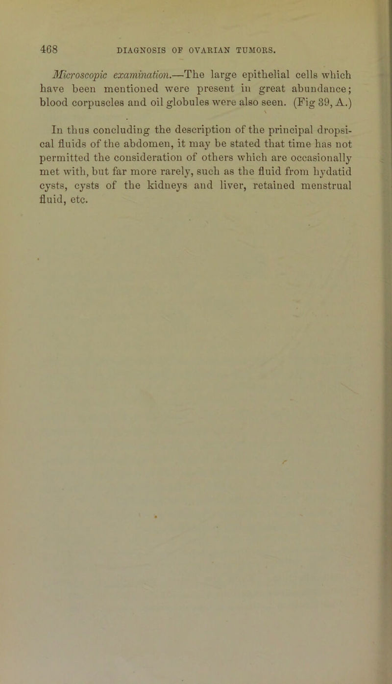 Microscopic examination.—The large epithelial cells which have been mentioned were present in great abundance; blood corpuscles and oil globules were also seen. (Fig 39, A.) \ In thus concluding the description of the principal dropsi- cal fluids of the abdomen, it may be stated that time has not permitted the consideration of others which are occasionally met with, but far more rarely, such as the fluid from hydatid cysts, cysts of the kidneys and liver, retained menstrual fluid, etc.