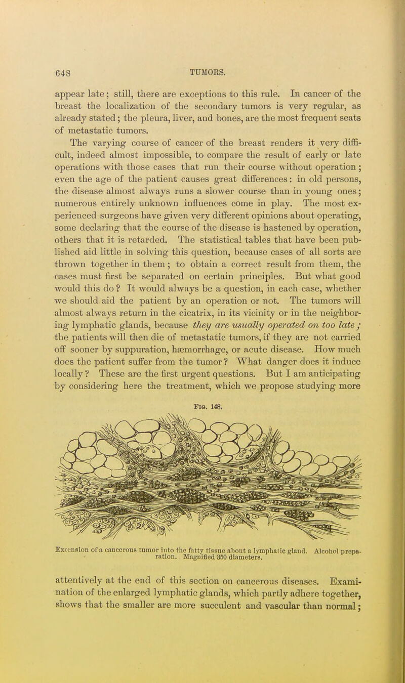 appear late; still, there are exceptions to this rule. In cancer of the breast the localization of the secondary tumors is very regular, as already stated; the pleura, liver, and bones, are the most frequent seats of metastatic tumors. The varying course of cancer of the breast renders it very diffi- cult, indeed almost impossible, to compare the result of early or late operations with those cases that run their course without operation ; even the age of the patient causes great diiferences: in old persons, the disease almost always runs a slower course than in young ones; numerous entirely unknown influences come in play. The most ex- perienced surgeons have given very different opinions about operating, some declaring that the course of the disease is hastened by ojieration, others that it is retarded. The statistical tables that have been pub- lished aid little in solving this question, because cases of all sorts are thrown together in them; to obtain a correct result from them, tbe cases must first be separated on certain principles. But what good would this do ? It would always be a question, in each case, whether we should aid the patient by an operation or not. The tumors 'vvill almost always return in the cicatrix, in its vicinity or in the neighbor- ing lymphatic glands, because they are usually operated on too late / the patients will then die of metastatic tumors, if they are not carried off sooner by suppuration, haemorrhage, or acute disease. How much does the patient suffer from the tumor ? What danger does it induce locally ? These are the first urgent questions. But I am anticipating by considering here the treatment, which we propose studying more Fio. 148. Exrension of a cancorons tumor into the fattv tissne nliont o Ivmphnlic gland. Alcohol propa- rntion. Mnguifled 350 tllametera. attentively at the end of this section on cancerous diseases. Exami- nation of the enlarged lymphatic glands, which partly adhere together, shows that the smaller are more succulent and vascular than normal;