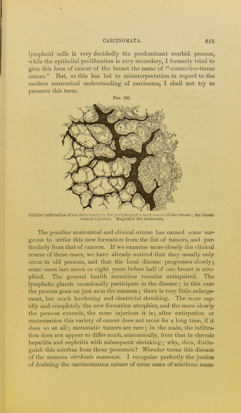 lymphoid cells is very decidedly the predominant morbid process, while the epithelial proliferation is very secondary, I formerly tried to give this form of cancer of the breast the name of  connective-tissue cancer. But, as this has led to misinteipretation in regard to the modern anatomical understanding of carcinoma, I shall not try to preserve this term. Pig. 150. Cellular infiltration of the fatty tissue i:i tlie ixTiphery of a hiird omcur of the breast; the blood- vessels iujected. Magnified 200 diameters. The peculiar anatomical and clinical course has caused some sur- geons to strike this new formation from the list of tumors, and par- ticularly from that of cancers. If we examine more closely the clinical course of these cases, we have already noticed that they usually only occur in old persons, and that the local disease progresses slowly; some cases last seven or eight years before half of one breast is atro- phied. The general health meantime remains unimpaired. The lymphatic glands occasionally participate in the disease ; in this case the process goes on just as in the mamma ; there is very little enlarge- ment, but much hardening and cicatricial shrinking. The more rap- idly and completely the new formation atrophies, and the more slowly the process extends, the more injurious it is; after extirpation or cauterization this variety of cancer does not recur for a long time, if it does so at all; metastatic tumors are rare ; in the main, the infiltra- tion does not appear to differ much, anatomically, from that in chronic hepatitis and nephritis with subsequent shrinking; why, then, distin- guish this scirrhus from those processes? Wernher terms this disease of the mamma cirrhosis mammcB. I recognize perfectly the justice of doubting the carcinomatous nature of some cases of scirrhous mam-