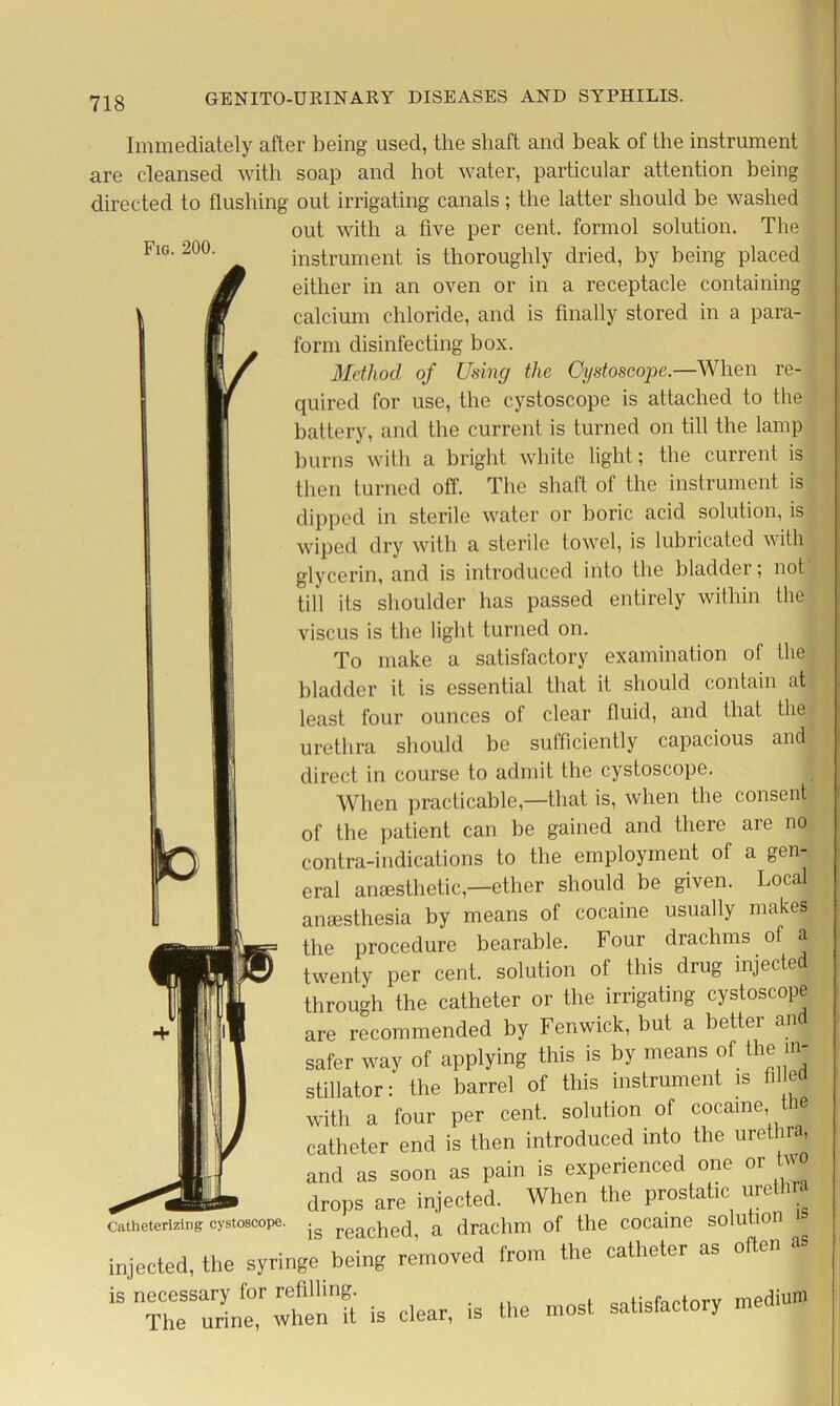 Fig. 200. Immediately after being used, the shaft and beak of the instrument are cleansed with soap and hot water, particular attention being directed to flushing out irrigating canals; the latter should be washed out with a five per cent, formol solution. The instrument is thoroughly dried, by being placed either in an oven or in a receptacle containing calcium chloride, and is finally stored in a para- form disinfecting box. Method of Using the Cystoscope.—When re- quired for use, the cystoscope is attached to the battery, and the current is turned on till the lamp burns with a bright white light; the current is then turned off. The shaft of the instrument is dipped in sterile water or boric acid solution, is wiped dry with a sterile towel, is lubricated with glycerin, and is introduced into the bladder; not till its shoulder has passed entirely within the viscus is the light turned on. To make a satisfactory examination of the bladder it is essential that it should contain at least four ounces of clear fluid, and that the urethra should be sufficiently capacious and direct in course to admit the cystoscope. When practicable—that is, when the consent of the patient can be gained and there are no contra-indications to the employment of a gen- eral anaesthetic,—ether should be given. Local anaesthesia by means of cocaine usually makes the procedure bearable. Four drachms of a twenty per cent, solution of this drug injected through the catheter or the irrigating cystoscope are recommended by Fenwick, but a better and safer way of applying this is by means of the m- stillator: the barrel of this instrument is i e with a four per cent, solution of cocaine, ie catheter end is then introduced into the urethra, and as soon as pain is experienced one or tw drops are injected. When the prostatic urethra is reached, a drachm of the cocaine solution is injected, the syringe being removed from the catheter as often is necessary for refilling. f t rv medium The urine, when it is clear, is the most satisfactory men Catheterizing cystoscope.