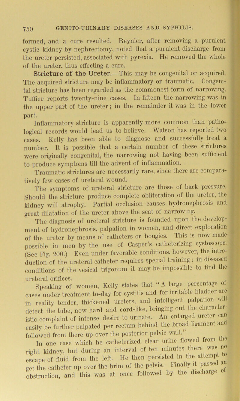 formed, and a cure resulted. Reynier, after removing a purulent cystic kidney by nephrectomy, noted that a purulent discharge from the ureter persisted, associated with pyrexia. He removed the whole of the ureter, thus effecting a cure. Stricture of the Ureter.—This may be congenital or acquired. The acquired stricture may be inflammatory or traumatic. Congeni- tal stricture has been regarded as the commonest form of narrowing. Tuffier reports twenty-nine cases. In fifteen the narrowing was in the upper part of the ureter; in the remainder it was in the lower part. Inflammatory stricture is apparently more common than patho- logical records would lead us to believe. Watson has reported two cases. Kelly has been able to diagnose and successfully treat a number. It is possible that a certain number of these strictures were originally congenital, the narrowing not having been sufficient to produce symptoms till the advent of inflammation. Traumatic strictures are necessarily rare, since there are compara- tively few cases of ureteral wound. The symptoms of ureteral stricture are those of back pressure. Should the stricture produce complete obliteration of the ureter, the kidney will atrophy. Partial occlusion causes hydronephrosis and great dilatation of the ureter above the seat of narrowing. The diagnosis of ureteral stricture is founded upon the develop- ment of hydronephrosis, palpation in women, and direct exploration of the ureter by means of catheters or bougies. This is now made possible in men by the use of Casper’s catheterizing cystoscope. (See Fig. 200.) Even under favorable conditions, however, the intro- duction of the ureteral catheter requires special training; in diseased conditions of the vesical trigonum it may be impossible to find the ureteral orifices. Speaking of women, Kelly states that “A large percentage ot cases under treatment to-day for cystitis and for irritable bladder are in reality tender, thickened ureters, and intelligent palpation wi detect the tube, now hard and cord-like, bringing out the character- istic complaint of intense desire to urinate. An enlarged ureter can easily be further palpated per rectum behind the broad ligament an followed from there up over the posterior pelvic wall.” In one case which he catheterized clear urine flowed from tne right kidney, but during an interval of ten minutes there was no escape of fluid from the left. He then persisted in the attempt t get the catheter up over the brim of the pelvis. Finally it passe a obstruction, and this was at once followed by the discharge