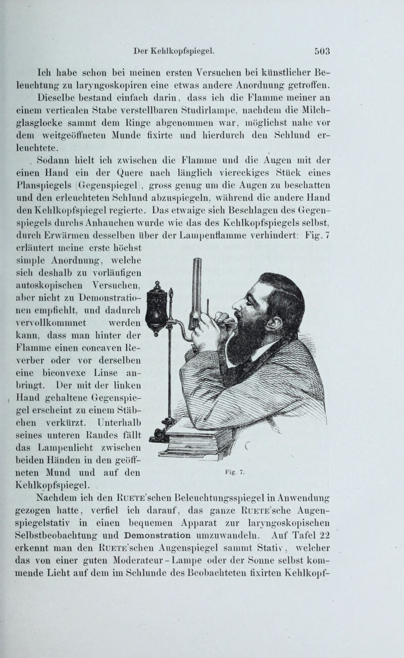 Ich habe schon bei meinen ersten Versuchen bei künstlicher Be- leuchtung' zu laryngoskopiren eine etwas andere Anordnung getroffen. Dieselbe bestand einfach darin, dass ich die Flamme meiner au einem verticalen Stabe verstellbaren Studirlainpe, nachdem die Milch- glasglocke sammt dem Hinge abgenommen war, möglichst nahe vor dem weitgeöffneten Munde tixirte und hierdurch den Schlund er- leuchtete. . Sodann hielt ich zwischen die Flamme und die Augen mit der einen Hand ein der Quere nach länglich viereckiges Stück eines Planspiegels (Gegenspiegel), gross genug um die Augen zu beschatten und den erleuchteten Schlund abzuspiegeln, während die andere Hand den Kehlkopfspiegel regierte. Das etwaige sich Beschlagen des Gegeu- spiegels durchs Anhauchen wurde wie das des Kehlkopfspiegels selbst, durch Erwärmen desselben über der Lampenflamme verhindert: Fig. 7 erläutert meine erste höchst simple Anordnung, welche sich deshalb zu vorläufigen autoskopischen Versuchen, aber nicht zu Demonstratio- nen empfiehlt, und dadurch vervollkommnet werden kann, dass man hinter der Flamme einen concaven Re- verber oder vor derselben eine biconvexe Linse an- briugt. Der mit der linken , Hand gehaltene Gegenspie- gel erscheint zu einem Stäb- chen verkürzt. Unterhalb seines unteren Bandes fällt das Lampenlicht zwischen beiden Händen in den geöff- neten Mund und auf den Fis ?■ Kehlkopfspiegel. Nachdem ich den RuETE’schen Beleuchtungsspiegel in Anwendung gezogen hatte, verfiel ich darauf, das ganze RuETESche Augeu- spiegelstativ in einen bequemen Apparat zur laryngoskopischeu Selbstbeobachtung und Demonstration umzuwandeln. Auf Tafel 22 erkennt man den RuETE’schen Augenspiegel sammt Stativ, welcher das von einer guten Moderateur - Lampe oder der Sonne selbst kom- mende Licht auf dem im Schlunde des Beobachteten fixirten Kehlkopf-