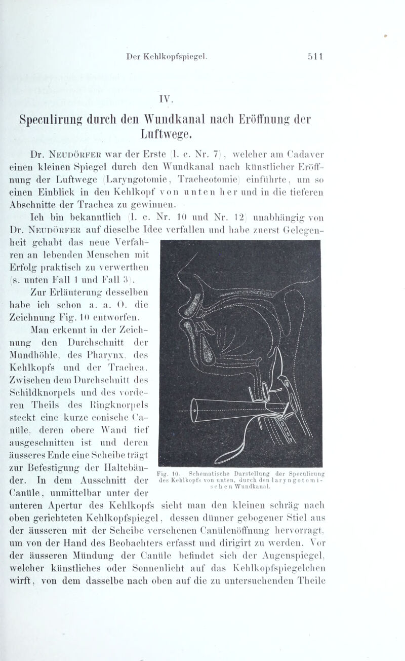 IV. Speculirung durch den Wundkanal nach Eröffnung der Luftwege. Dr. Neudörfer war der Erste 1. c. Nr. 7 , welcher am Cadaver einen kleinen Spiegel durch den Wundkanal nach künstlicher Eröff- nung der Luftwege Laryngotomie, Tracheotomie) einführte, um so einen Einblick in den Kehlkopf von unten her und in die, tieferen Abschnitte der Trachea zu gewinnen. Ich bin bekanntlich 1. c. Nr. 10 und Nr. 12 unabhängig von Dr. Neudörfer auf dieselbe Idee verfallen und habe zuerst Gelegen- heit gehabt das neue Verfah- ren an lebenden Menschen mit Erfolg praktisch zu verwerthen s. unten Fall 1 und Fall 5 . Zur Erläuterung desselben habe ich schon a. a. 0. die Zeichnung Fig. 10 entworfen. Mau erkennt in der Zeich- nung den Durchschnitt der Mundhöhle, des Pharvnx, des Kehlkopfs und der Trachea. Zwischen dem Durchschnitt des Schildknorpels und des vorde- ren Theils des Ringknorpels steckt eine kurze conische ('a- niile, deren obere Wand tief ausgeschnitten ist und deren äusseres Ende eine Scheibe trägt zur Befestigung der Haltebän- der. In dem Ausschnitt der Canüle, unmittelbar unter der unteren Apertur des Kehlkopfs sieht man den kleinen schräg nach oben gerichteten Kehlkopfspiegel, dessen dünner gebogener Stiel aus der äusseren mit der Scheibe versehenen Caniilenöffnung hervorragt, um von der Hand des Beobachters erfasst und dirigirt zu werden. Vor der äusseren Mündung der Canüle befindet sich der Augenspiegel, welcher künstliches oder Sonnenlicht auf das Kehlkopfspiegelchen wirft. von dem dasselbe nach oben auf die zu untersuchenden Theile Fig. 10- Schematische Darstellung der Speculirung des Kehlkopfs von unten, durch den laryngotomi- sehen Wundkanal.