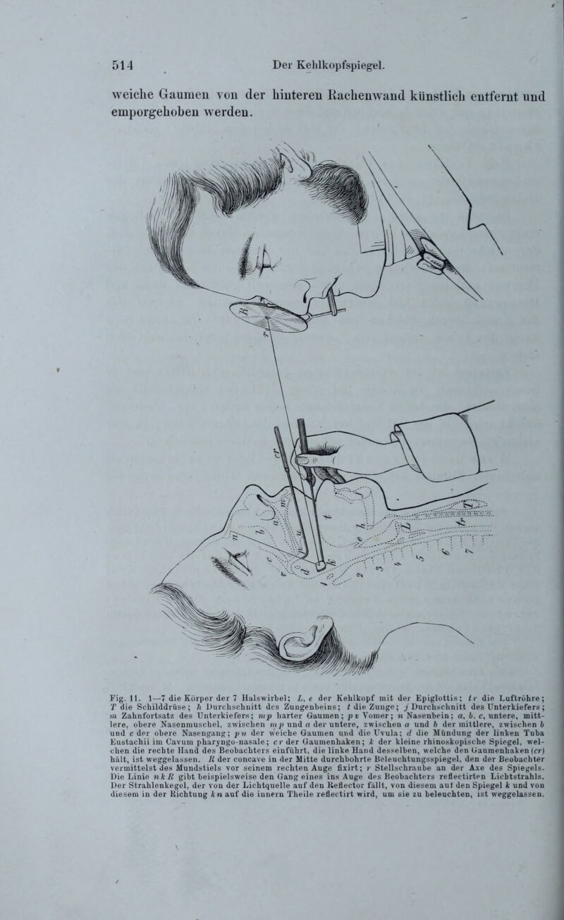 weiche Gaumen von (1er hinteren Kacheuwand künstlich entfernt und einporgehobeu werden. Fig. 11. 1—7 die Körper der 7 Halswirbel; e der Kehlkopf mit der Epiglottis; ir die Luftröhre; T die Schilddrüse; h Durchschnitt des Zungenbeins; / die Zunge; j Durchschnitt des Unterkiefers; m Zahnfortsatz des Unterkiefers; mp harter Gaumen; p v Vomer; n Nasenbein; «, 1. c, untere, mitt- lere, obere Nasenmuschel, zwischen mp und a der untere, zwischen« und b der mittlere, zwischen!» und c der obere Nasengang; ptt der weiche Gaumen und die Uvula; d die Mündung der linken Tuba Eustachii im Cavum pharyngo-nasale; er der Gaumenhaken; k der kleine rhinoskopische Spiegel, wel- chen die rechte Hand des Beobachters eiufiihrt, die linke Hand desselben, welche den Gaumenhaken (er) hält, ist weggelassen. R der concave in der Mitte durchbohrte Beleuchtungsspiegel, den der Beobachter vermittelst des Mundstiels vor seinem rechten Auge fixirt; r Stellschraube an der Axe des Spiegels. Die Linie nk R gibt beispielsweise den Gang eines ins Auge des Beobachters refleetirten Lichtstrahls. Der Strahlenkegel, der von der Lichtquelle auf den Keflector fällt, von diesem aut den Spiegel k und von diesem in der Richtung kn auf die innern Theile reflectirt wird, um sie zu beleuchten, ist weggelassen.