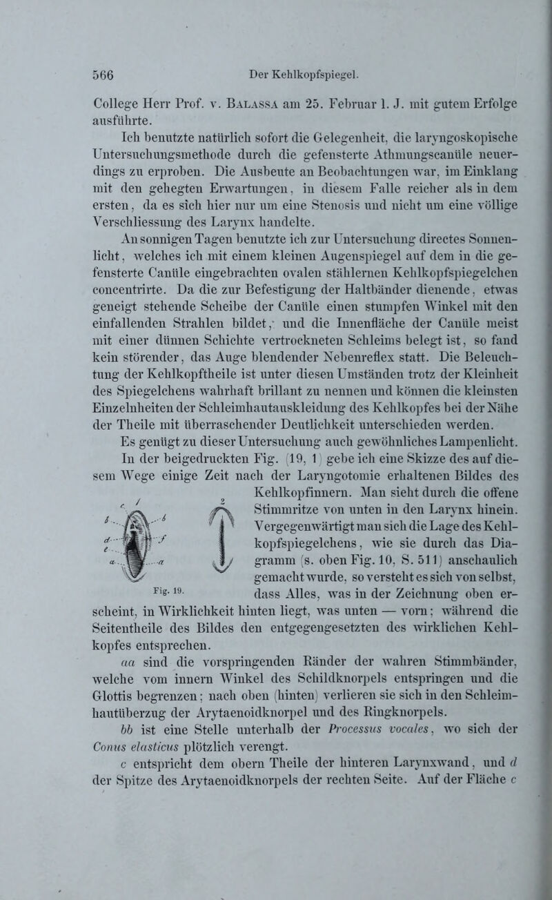 Balassa am 25. Februar l.J. mit gutem Erfolge College Herr Prof, v ausführte. Ich benutzte natürlich sofort die Gelegenheit, die laryngoskopische Untersuchungsmethode durch die gefensterte Athmungscanüle neuer- dings zn erproben. Die Ansbeute an Beobachtungen war, im Einklang mit den gehegten Erwartungen, in diesem Falle reicher als in dem ersten, da es sich hier nur um eine Stenosis und nicht um eine völlige Verschliessung des Larynx handelte. An sonnigen Tagen benutzte ich zur Untersuchung directes Sonnen- licht , welches ich mit einem kleinen Augenspiegel auf dem in die ge- fensterte C'antile eingebrachten ovalen stählernen Kehlkopfspiegelchen concentrirte. Da die zur Befestigung der Haltbänder dienende, etwas geneigt stehende Scheibe der Caniile einen stumpfen Winkel mit den einfallenden Strahlen bildet,* und die Innenfläche der Caniile meist mit einer dünnen Schichte vertrockneten Schleims belegt ist, so fand kein störender, das Auge blendender Nebenreflex statt. Die Beleuch- tung der Kehlkopftheile ist unter diesen Umständen trotz der Kleinheit des Spiegelchens wahrhaft brillant zu nennen und können die kleinsten Einzelnheiten der Schleimhautauskleidung des Kehlkopfes bei der Nähe der Theile mit überraschender Deutlichkeit unterschieden werden. Es genügt zu dieser Untersuchung auch gewöhnliches Lampenlicht. In der beigedruckten Fig. (19, 1 gebe ich eine Skizze des auf die- sem Wege einige Zeit nach der Laryngotomie erhaltenen Bildes des Kehlkopfinnern. Man sieht durch die offene Stimmritze von unten in den Larynx hinein. Vergegenwärtigt man sich die Lage des Kehl- kopfspiegelchens, wie sie durch das Dia- gramm (s. oben Fig. 10, S. 511) anschaulich gemacht wurde, so versteht es sich von selbst, dass Alles, was in der Zeichnung oben er- scheint, in Wirklichkeit hinten liegt, was unten — vorn: während die Seitentheile des Bildes den entgegengesetzten des wirklichen Kehl- kopfes entsprechen. an sind die vorspringenden Ränder der wahren Stimmbänder, welche vom innern Winkel des Schildknorpels entspringen und die Glottis begrenzen; nach oben (hinten) verlieren sie sich in den Schleim- hautüberzug der Arytaenoidknorpel und des Ringknorpels. bb ist eine Stelle unterhalb der Processus vocales, wo sich der Conus elasticus plötzlich verengt. c entspricht dem obern Theile der hinteren Larynxwand. und d der Spitze des Arytaenoidknorpels der rechten Seite. Auf der Fläche c c. ' ‘fjl' sy Fig. 19.