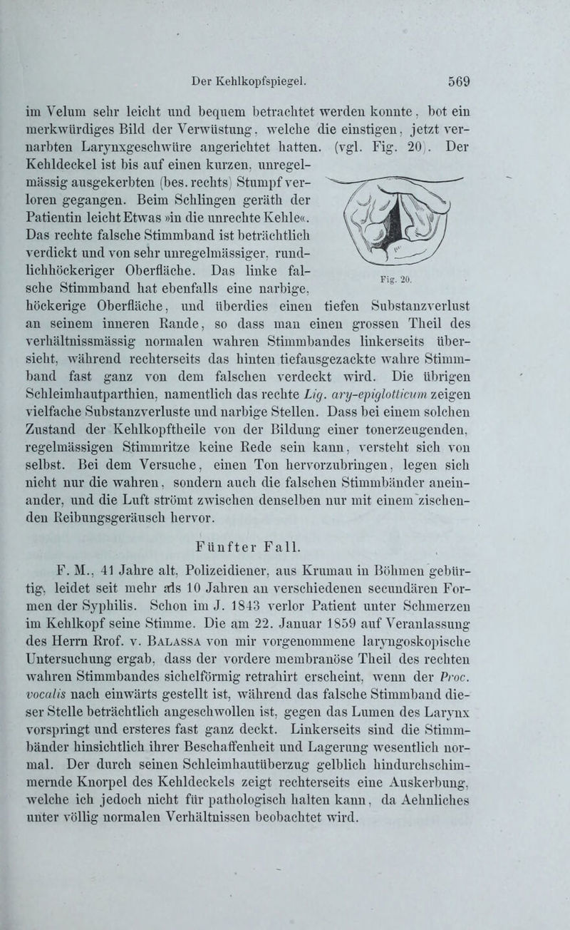 im Velum sehr leicht und bequem betrachtet werden kouute, bot eiu merkwürdiges Bild der Verwüstung, welche die einstigen, jetzt ver- narbten Larynxgeschwüre angerichtet hatten, (vgl. Fig. 20 . Der Kehldeckel ist bis auf einen kurzen, unregel- mässig ausgekerbten (bes. rechts) Stumpf ver- loren gegangen. Beim Schlingen geräth der Patientin leicht Etwas »in die Unrechte Kehle«. Das rechte falsche Stimmband ist beträchtlich verdickt und von sehr unregelmässiger, rund- lichhöckeriger Oberfläche. Das linke fal- sche Stimmband hat ebenfalls eine narbige, höckerige Oberfläche, und überdies einen tiefen Substanzverlust an seinem inneren Rande, so dass man einen grossen Theil des verhältnissmässig normalen wahren Stimmbandes linkerseits über- sieht, während rechterseits das hinten tiefausgezackte wahre Stimm- band fast ganz von dem falschen verdeckt wird. Die übrigen Schleimhautparthien, namentlich das rechte Lig. ary-epiglotticum zeigen vielfache Substanzverluste und narbige Stellen. Dass bei einem solchen Zustand der Kehlkopftheile von der Bildung einer tonerzeugenden, regelmässigen Stimmritze keine Rede sein kann, versteht sich von selbst. Bei dem Versuche, einen Ton hervorzubringen, legen sich nicht nur die wahren, sondern auch die falschen Stimmbänder anein- ander, lind die Luft strömt zwischen denselben nur mit einem zischen- den Reibungsgeräusch hervor. Fünfter Fall. F. M., 41 Jahre alt. Polizeidiener, aus Krurnau in Böhmen gebür- tig, leidet seit mehr als 10 Jahren an verschiedenen secundären For- men der Syphilis. Schon im J. 1843 verlor Patient unter Schmerzen im Kehlkopf seine Stimme. Die am 22. Januar 1859 auf Veranlassung des Herrn Rrof. v. Balassa von mir vorgenommene laryngoskopisclie Untersuchung ergab, dass der vordere membranöse Theil des rechten Avahren Stimmbandes sichelförmig retrahirt erscheint, Avenn der Proc. vocalis nach einwärts gestellt ist, während das falsche Stimmband die- ser Stelle beträchtlich angescliAvollen ist, gegen das Lumen des Larvnx vorspringt und ersteres fast ganz deckt. Linkerseits sind die Stimm- bänder hinsichtlich ihrer Beschaffenheit und Lagerung Avesentlich nor- mal. Der durch seinen Schleimhautüberzug gelblich hindurchschim- mernde Knorpel des Kehldeckels zeigt rechterseits eine Auskerbung, welche ich jedoch nicht für pathologisch halten kann, da Aehnliches unter völlig normalen Verhältnissen beobachtet wird.
