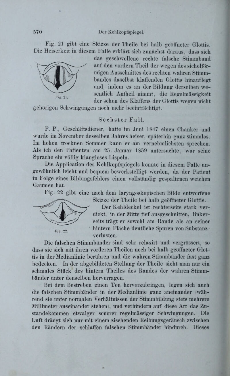 Fig\ 21 gibt eine Skizze der Theile bei halb geöffneter Glottis. Die Heiserkeit in diesem Falle erklärt sich zunächst daraus, dass sich das geschwollene rechte falsche Stimmband auf den vordem Theil der wegen des sichelför- migen Ausschnittes des rechten wahren Stimm- bandes daselbst klaffenden Glottis hinauflegt und, indem es an der Bildung derselben we- sentlich Antheil nimmt, die Regelmässigkeit der schon des Klaffens der Glottis wegen nicht gehörigen Schwingungen noch mehr beeinträchtigt. Sechster Fall. P. P., Geschäftsdiener, hatte im Jnni 1847 einen Chanker und wurde im November desselben Jahres heiser, späterhin ganz stimmlos. Im hohen trocknen Sommer kann er am vernehmlichsten sprechen. Als ich den Patienten am 25. Januar 1859 untersuchte, war seine Sprache ein völlig klangloses Lispeln. Die Application des Kehlkopfspiegels konnte in diesem Falle un- gewöhnlich leicht und bequem bewerkstelligt werden, da der Patient in Folge eines Bildungsfehlers einen vollständig gespaltenen weichen Gaumen hat. Fig. 22 gibt eine nach dem laryngoskopischen Bilde entworfene Skizze der Theile bei halb geöffneter Glottis. Der Kehldeckel ist reckterseits stark ver- dickt, in der Mitte tief ausgeschnitten, linker- seits trägt er sowohl am Rande als an seiner hintern Fläche deutliche Spuren von Substanz- verlusten. Die falschen Stimmbänder sind sehr relaxirt und vergrössert, so dass sie sich mit ihren vorderen Theilen noch bei halb geöffneter Glot- tis in der Medianlinie berühren und die wahren Stimmbänder fast ganz bedecken. In der abgebildeten Stellung der Theile sieht man nur ein schmales Stück des hintern Theiles des Randes der wahren Stimm- bänder unter denselben hervorragen. Bei dem Bestreben einen Ton hervorzubringen, legen sich auch die falschen Stimmbänder in der Medianlinie ganz aneinander (wäh- rend sie unter normalen Verhältnissen der Stimmbildung stets mehrere Millimeter auseinander stehen), und verhindern auf diese Art das Zu- standekommen etwaiger sonorer regelmässiger Schwingungen. Die Luft drängt sich nur mit einem zischenden Reibungsgeräusch zwischen den Rändern der schlaffen falschen Stimmbänder hindurch. Dieses