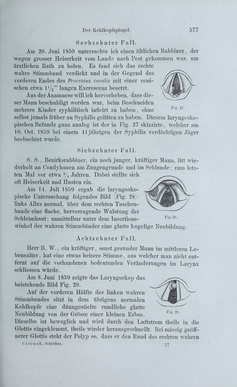 Sech zehnter Fall. Am 20. Juni 1859 untersuchte ich einen ältlichen Rabbiner, der wegen grosser Heiserkeit vom Lande nach Pest gekommen war, um ärztlichen Rath zu holen. Es fand sich das rechte wahre Stimmband verdickt und in der Gegend des vorderen Endes des Processus vocalis mit einer coni- schen etwa 1i/2” langen Excrescenz besetzt. Aus der Anamnese will ich hervorheben, dass die- ser Mann beschuldigt worden war, beim Beschneiden mehrere Kinder syphilitisch inficirt zu haben, ohne selbst jemals früher an Syphilis gelitten zu haben. Diesem laryngosko- pischen Befunde ganz analog ist der in Fig. 27 skizzirte, welcher am 10. Oct. 1859 bei einem 41jährigen der Syphilis verdächtigen Jäger beobachtet wurde. Siebzehnter Fall. S. S., Bezirksrabbiner, ein noch junger, kräftiger Mann, litt wie- derholt an Condylomen am Zungengrunde und im Schlunde; zum letz- ten Mal vor etwa 3/4 Jahren. Dabei stellte sich oft Heiserkeit und Husten ein. Am 14. Juli 1859 ergab die laryngosko- pische Untersuchung folgendes Bild (Fig. 28): links Alles normal, über dem rechten Taschen- bande eine flache, hervorragende Wulstung der Schleimhaut; unmittelbar unter dem Insertions- winkel der wahren Stimmbänder eine glatte kugelige Neubildung. Achtzehnter Fall. Herr B. W., ein kräftiger, sonst gesunder Mann im mittleren Le- bensalter , hat eine etwas heisere Stimme, aus welcher man nicht ent- fernt auf die vorhandenen bedeutenden Veränderungen im Larynx schliessen würde. Am 8. Juni 1859 zeigte das Laryngoskop das beistehende Bild Fig. 29. Auf der vorderen Hälfte des linken wahren Stimmbandes sitzt in dem übrigens normalen Kehlkopfe eine dünngestielte rundliche glatte Neubildung von der Grösse einer kleinen Erbse. Dieselbe ist beweglich und wird durch den Luftstrom theils in die Glottis eingeklemmt, theils wieder herausgeschnellt. Bei mässig geöff- neter Glottis steht der Polyp so, dass er den Rand des rechten wahren Czermak, Schriften. Fig. 27. 37