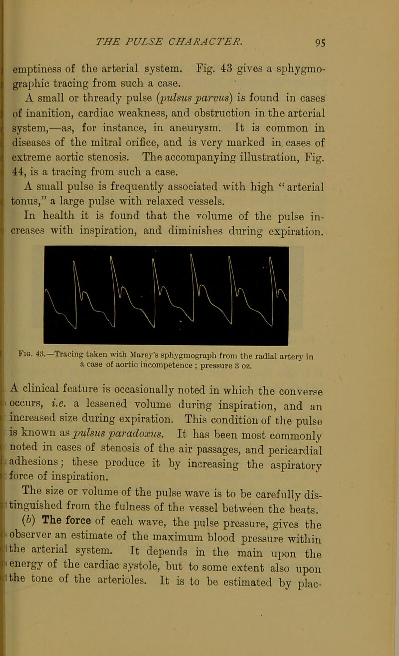 emptiness of the arterial system. Fig. 43 gives a sphygmo- graphic tracing from such a case. A small or thready pulse (pulsus parvus) is found in cases of inanition, cardiac weakness, and obstruction in the arterial system,—as, for instance, in aneurysm. It is common in diseases of the mitral orifice, and is very marked in cases of extreme aortic stenosis. The accompanying illustration, Fig. 44, is a tracing from such a case. A small pulse is frequently associated with high “ arterial tonus,” a large pulse with relaxed vessels. In health it is found that the volume of the pulse in- creases with inspiration, and diminishes during expiration. Fig. 43.—Tracing taken with Marey’s sphygmograph from the radial artery in a case of aortic incompetence ; pressure 3 oz. A clinical feature is occasionally noted in which the converse i' occurs, i.e. a lessened volume during inspiration, and an increased size during expiration. This condition of the pulse is known as p>ulsus paradoxus. It has been most commonly noted in cases of stenosis of the air passages, and pericardial adhesions; these produce it by increasing the aspiratory force of inspiration. The size or volume of the pulse wave is to be carefully dis- tinguished from the fulness of the vessel between the beats. (b) The force of each wave, the pulse pressure, gives the 1 observer an estimate of the maximum blood pressure within i the arterial system. It depends in the main upon the ' energy of the cardiac systole, but to some extent also upon ‘ the tone of the arterioles. It is to be estimated by plac-