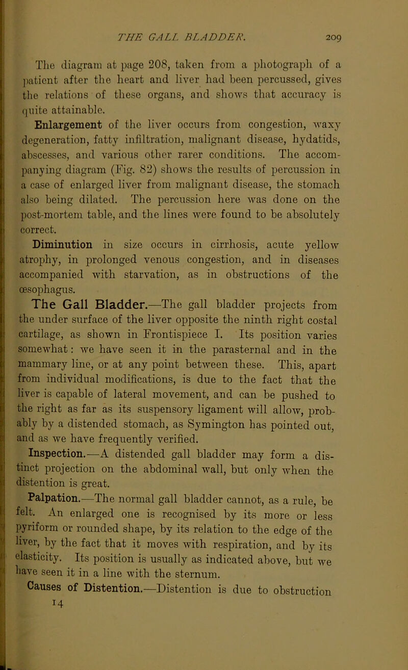 The diagram at page 208, taken from a photograph of a patient after the heart and liver had been percussed, gives the relations of these organs, and shows that accuracy is quite attainable. Enlargement of the liver occurs from congestion, waxy degeneration, fatty infiltration, malignant disease, hydatids, abscesses, and various other rarer conditions. The accom- panying diagram (Fig. 82) shows the results of percussion in a case of enlarged liver from malignant disease, the stomach also being dilated. The percussion here was done on the post-mortem table, and the lines were found to be absolutely correct. Diminution in size occurs in cirrhosis, acute yellow atrophy, in prolonged venous congestion, and in diseases accompanied with starvation, as in obstructions of the oesophagus. The Gall Bladder .—The gall bladder projects from the under surface of the liver opposite the ninth right costal cartilage, as shown in Frontispiece I. Its position varies somewhat: we have seen it in the parasternal and in the mammary line, or at any point between these. This, apart from individual modifications, is due to the fact that the liver is capable of lateral movement, and can be pushed to the right as far as its suspensory ligament will allow, prob- ably by a distended stomach, as Symington has pointed out, and as we have frequently verified. Inspection.—A distended gall bladder may form a dis- tinct projection on the abdominal wall, but only when the distention is great. Palpation.—The normal gall bladder cannot, as a rule, be felt. An enlarged one is recognised by its more or less pyriform or rounded shape, by its relation to the edge of the liver, by the fact that it moves with respiration, and by its elasticity. Its position is usually as indicated above, but we have seen it in a line with the sternum. Causes of Distention.—Distention is due to obstruction 14