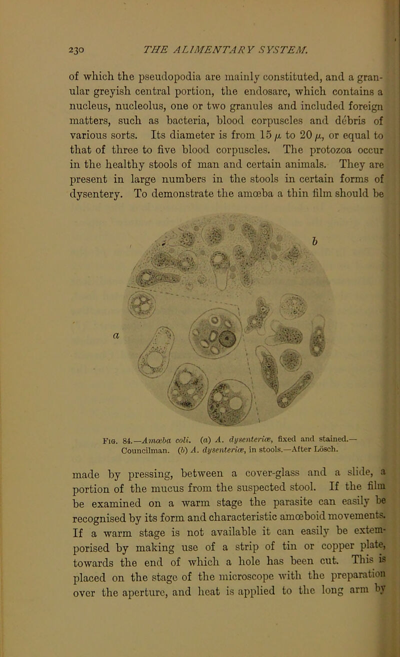 of which the pseudopodia are mainly constituted, and a gran- ular greyish central portion, the endosarc, which contains a nucleus, nucleolus, one or two granules and included foreign matters, such as bacteria, blood corpuscles and debris of various sorts. Its diameter is from 15 /x to 20 p, or equal to that of three to five blood corpuscles. The protozoa occur in the healthy stools of man and certain animals. They are present in large numbers in the stools in certain forms of dysentery. To demonstrate the amoeba a thin film should be Fig. 84 .—Amoeba coli. (a) A. dy sente rice, fixed and stained.— Councilman. (6) A. dysenteries, in stools.—After Losch. made by pressing, between a cover-glass and a slide, a portion of the mucus from the suspected stool. If the film be examined on a warm stage the parasite can easily be recognised by its form and characteristic amoeboid movements. If a warm stage is not available it can easily be extem- porised by making use of a strip of tin or copper plate, towards the end of which a hole has been cut. This is placed on the stage of the microscope with the preparation over the aperture, and heat is applied to the long arm by