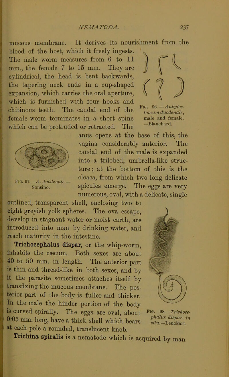 Fig. 96. — Ankylos- tomum duodenale, male and female. —Blanchard. Fig. 97.—A. duodenale.— Sonsino. mucous membrane. It derives its nourishment from the blood of the host, which it freely ingests. The male worm measures from 6 to 11 mm., the female 7 to 15 mm. They are cylindrical, the head is bent backwards, the tapering neck ends in a cup-shaped expansion, which carries the oral aperture, which is furnished with four hooks and chitinous teeth. The caudal end of the female worm terminates in a short spine which can be protruded or retracted. The anus opens at the base of this, the vagina considerably anterior. The caudal end of the male is expanded into a trilobed, umbrella-like struc- ture; at the bottom of this is the cloaca, from which two long delicate spicules emerge. The eggs are very numerous, oval, with a delicate, single outlined, transparent shell, enclosing two to eight greyish yolk spheres. The ova escape, develop in stagnant water or moist earth, are introduced into man by drinking water, and reach maturity in the intestine. Trichocephalus dispar, or the whip-worm, inhabits the caecum. Both sexes are about 40 to 50 mm. in length. The anterior part is thin and thread-like in both sexes, and by it the parasite sometimes attaches itself by transfixing the mucous membrane. The pos- terior part of the body is fuller and thicker. In the male the hinder portion of the body is curved spirally. The eggs are oval, about 0’05 mm. long, have a thick shell which bears at each pole a rounded, translucent knob. Trichina spiralis is a nematode which is acquired by man Fig. 98.—Trichoce- phalus dispar, in situ.—Leuckart.