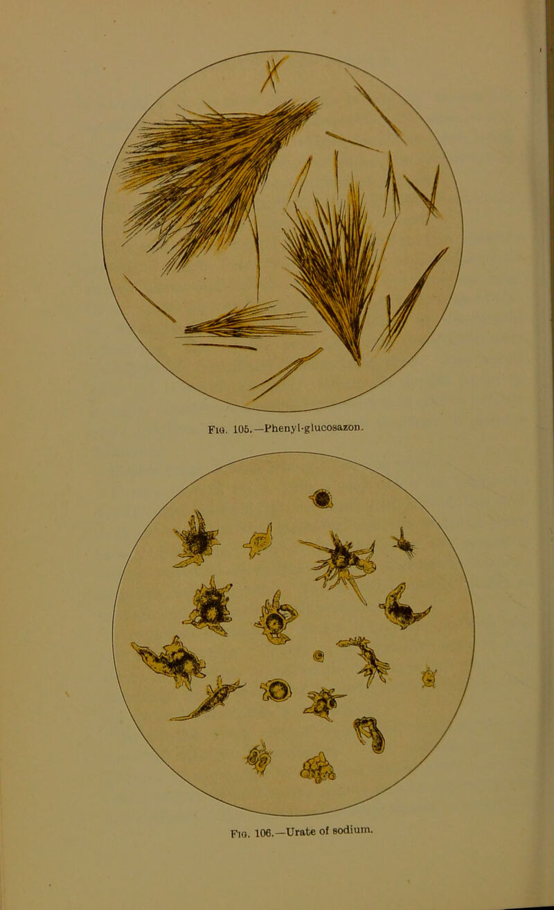 Fio. 106.—Urate of sodium.