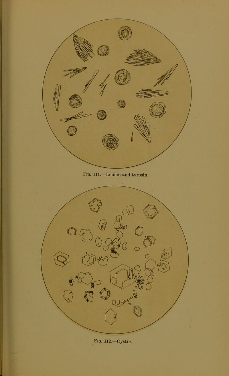 Fiq. 1X2.—Cystic.
