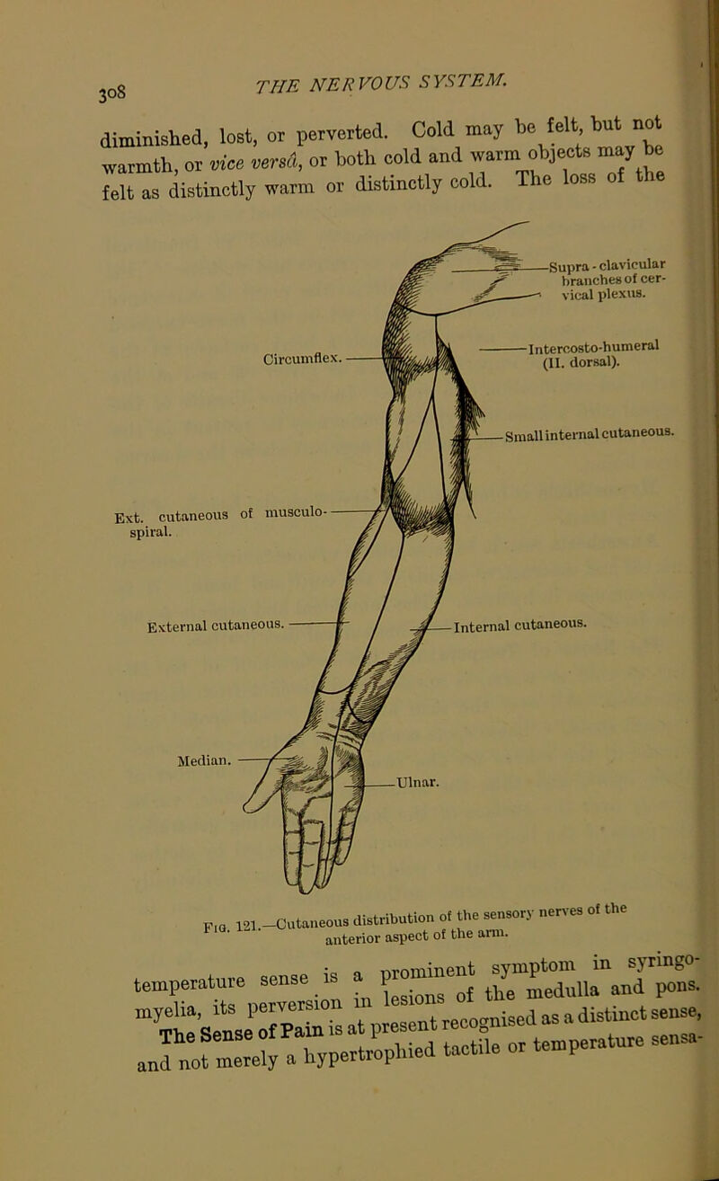 30g the ner VO us s ystem. diminished, lost, or perverted. Cold may be felt but not warmth, or vice versa, or both cold and warm objects may be felt as distinctly warm or distinctly cold. The loss of the Circumflex. Ext. cutaneous of musculo- spiral. External cutaneous. Median. Supra - clavicular branches of cer- vical plexus. Intercosto-humeral (II. dorsal). Small internal cutaneous. Internal cutaneous. Ulnar. F,q. 121.—Cutaneous distribution of the sensory nerves of the anterior aspect of the arm. ic i Tvrominent symptom in syringo- temperature sense is . ? omme P and
