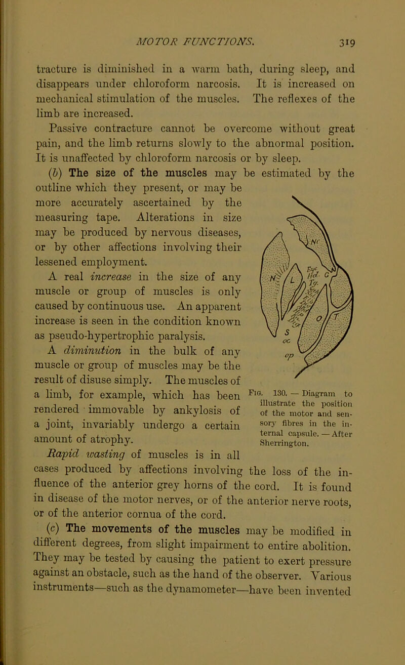tracture is diminished in a warm bath, during sleep, and disappears under chloroform narcosis. It is increased on mechanical stimulation of the muscles. The reflexes of the limb are increased. Passive contracture cannot he overcome without great pain, and the limb returns slowly to the abnormal position. It is unaffected by chloroform narcosis or by sleep. (b) The size of the muscles may be estimated by the outline which they present, or may be more accurately ascertained by the measuring tape. Alterations in size may be produced by nervous diseases, or by other affections involving their lessened employment. A real increase in the size of any muscle or group of muscles is only caused by continuous use. An apparent increase is seen in the condition known as pseudo-hypertrophic paralysis. A diminution in the bulk of any muscle or group of muscles may be the result of disuse simply. The muscles of a limb, for example, which has been rendered immovable by ankylosis of a joint, invariably undergo a certain amount of atrophy. Rapid wasting of muscles is in all cases produced by affections involving the loss of the in- fluence of the anterior grey horns of the cord. It is found Fig. 130. — Diagram to illustrate the position of the motor and sen- sory fibres in the in- ternal capsule. — After Sherrington. in disease of the motor nerves, or of the anterior nerve roots, or of the anterior cornua of the cord. (c) The movements of the muscles may be modified in different degrees, from slight impairment to entire abolition. They may be tested by causing the patient to exert pressure against an obstacle, such as the hand of the observer. Various instruments—such as the dynamometer—have been invented