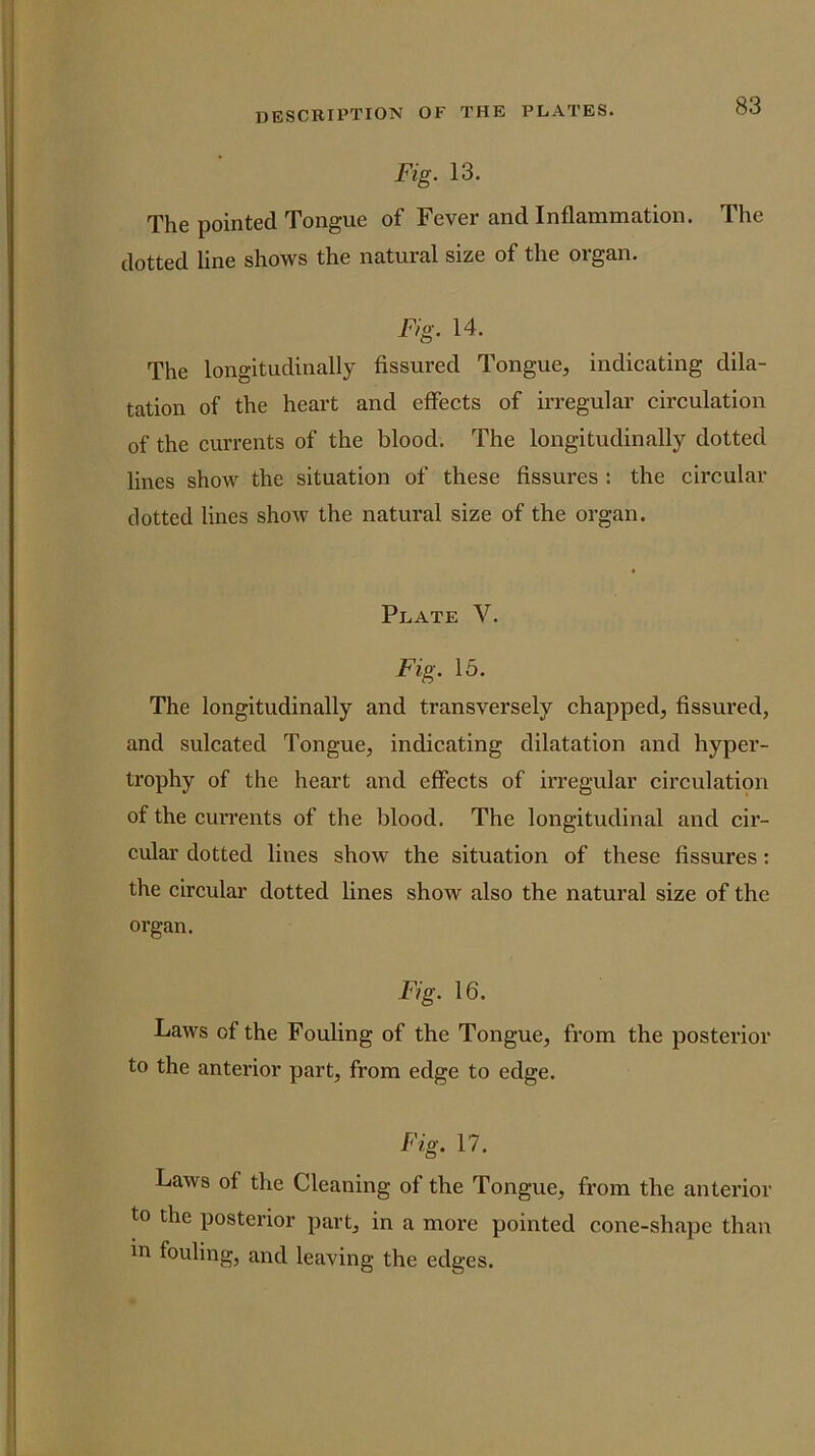 Fig. 13. The pointed Tongue of Fever and Inflammation. The dotted line shows the natural size of the organ. Fig. 14. The longitudinally fissured Tongue, indicating dila- tation of the heart and effects of irregular circulation of the currents of the blood. The longitudinally dotted lines show the situation of these fissures : the circular dotted lines show the natural size of the organ. Plate V. Fig. 15. The longitudinally and transversely chapped, fissured, and sulcated Tongue, indicating dilatation and hyper- trophy of the heart and effects of irregular circulation of the currents of the blood. The longitudinal and cir- cular dotted lines show the situation of these fissures: the eircular dotted lines show also the natural size of the organ. Fig. 16. Laws of the Fouling of the Tongue, from the posterior to the anterior part, from edge to edge. Fig. 17. Laws of the Cleaning of the Tongue, from the anterior to the posterior part, in a more pointed cone-shape than in fouling, and leaving the edges.