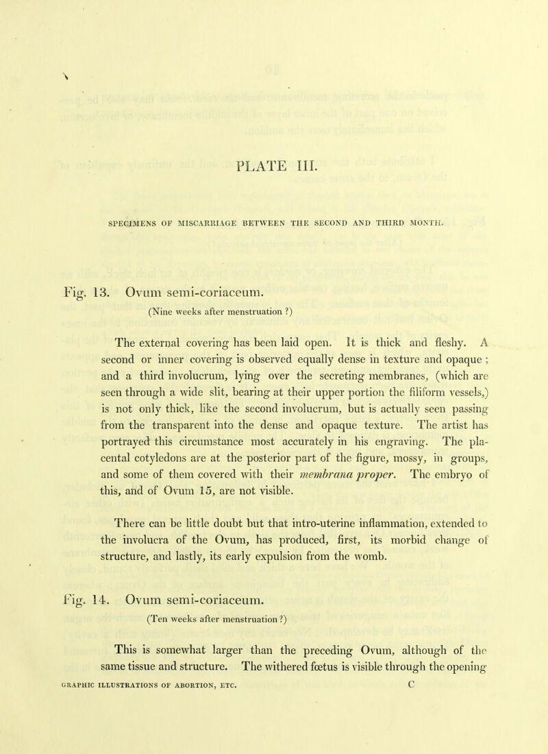 SPEGJMENS OF MISCARRIAGE BETWEEN THE SECOND AND THIRD MONTH. Fig, 13. Ovum semi-coriaceLim. (Nine weeks after menstruation ?) The external covering has been laid open. It is thick and fleshy. A second or inner covering is observed equally dense in texture and opaque ; and a third involucrum, lying over the secreting membranes, (which are seen through a wide slit, bearing at their upper portion the filiform vessels,) is not only thick, like the second involucrum, but is actually seen passing from the transparent into the dense and opaque texture. The artist has portrayed this circumstance most accurately in his engraving. The pla- cental cotyledons are at the posterior part of the figure, mossy, in groups, and some of them covered with their memhrana proper. The embryo of this, and of Ovum 15, are not visible. There can be little doubt but that intro-uterine inflammation, extended to the involucra of the Ovum, has produced, first, its morbid change of structure, and lastly, its early expulsion from the womb. Fig. 14. Ovum semi-coriaceum. (Ten weeks after menstruation ?) This is somewhat larger than the preceding Ovum, although of the same tissue and structure. The withered foetus is visible through the opening GRAPHIC ILLUSTRATIONS OF ABORTION, ETC. C