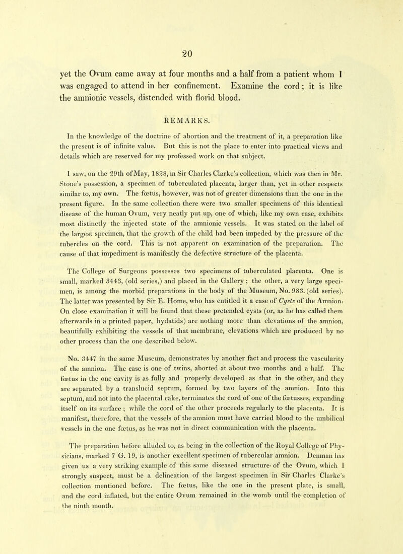 yet the Ovum came away at four months and a half from a patient whom I was engaged to attend in her confinement. Examine the cord; it is Hke the amnionic vessels, distended with florid blood. REMARKS. In the knowledge of the doctrine of abortion and the treatment of it, a preparation like the present is of infinite value. But this is not the place to enter into practical views and details which are reserved for my professed work on that subject. I saw, on the 29th of May, 1828, in Sir Charles Clarke's collection, which was then in Mr. Stone's possession, a specimen of tuberculated placenta, larger than, yet in other respects similar to, my own. The foetus, however, was not of greater dimensions than the one in the present figure. In the same collection there were two smaller specimens of this identical disease of the human Ovum, very neatly put up, one of which, like my own case, exhibits most distinctly the injected state of the amnionic vessels. It was stated on the label of the largest specimen, that the growth of the child had been impeded by the pressure of the tubercles on the cord. This is not apparent on examination of the preparation. The cause of that impediment is manifestly the defective structure of the placenta. The College of Surgeons possesses two specimens of tuberculated placenta. One is small, marked 3443, (old series,) and placed in the Gallery ; the other, a very large speci- men, is among the morbid preparations in the body of the Museum, No. 983. (old series). The latter was presented by Sir E. Home, who has entitled it a case of Cysts of the Amnions On close examination it will be found that these pretended cysts (or, as he has called them afterwards in a printed paper, hydatids) are nothing more than elevations of the amnion, beautifully exhibiting the vessels of that membrane, elevations which are produced by no other process than the one described below. No. 3447 in the same Museum, demonstrates by another fact and process the vascularity of the amnion. The case is one of twins, aborted at about two months and a half The foetus in the one cavity is as fully and properly developed as that in the other, and they are separated by a translucid septum, formed by two layers of the amnion. Into this septum, and not into the placental cake, terminates the cord of one of the foetusses, expanding itself on its surface ; while the cord of the other proceeds regularly to the placenta. It is manifest, therefore, that the vessels of the amnion must have carried blood to the umbilical vessels in the one foetus, as he was not in direct communication with the placenta. The preparation before alluded to, as being in the collection of the Royal College of Phy- sicians, marked 7 G. 19, is another excellent specimen of tubercular amnion. Denman has given us a very striking example of this same diseased structure of the Ovum, which I strongly suspect, must be a delineation of the largest specimen in Sir Charles Clarke's collection mentioned before. The foetus, like the one in the present plate, is small, and the cord inflated, but the entire Ovum remained in the womb until the completion of the ninth month.