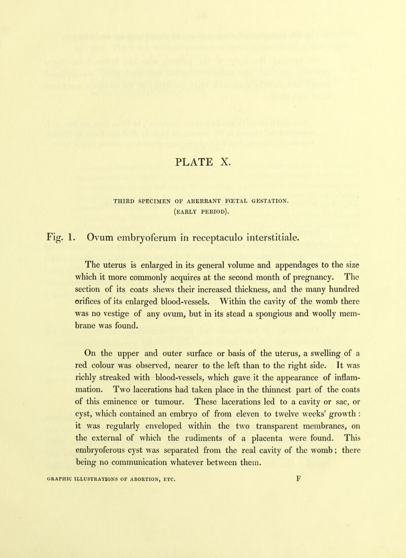 third specimen of aberrant fcetal gestation, (early period). Fig. 1. Ovum embryoferum in receptaculo interstitiale. The uterus is enlarged in its general volume and appendages to the size which it more commonly acquires at the second month of pregnancy. The section of its coats shews their increased thickness, and the many hundred orifices of its enlarged blood-vessels. Within the cavity of the womb there was no vestige of any ovum, but in its stead a spongious and woolly mem- brane was found. On the upper and outer surface or basis of the uterus, a swelling of a red colour was observed, nearer to the left than to the right side. It was richly streaked with blood-vessels, which gave it the appearance of inflam- mation. Two lacerations had taken place in the thinnest part of the coats of this eminence or tumour. These lacerations led to a cavity or sac, or cyst, which contained an embryo of from eleven to twelve weeks' growth: it was regularly enveloped within the two transparent membranes, on the external of which the rudiments of a placenta were found. This embryoferous cyst was separated from the real cavity of the womb; there being no communication whatever between them. GRAPHIC ILLUSTRATIONS OF ABORTION, ETC. F