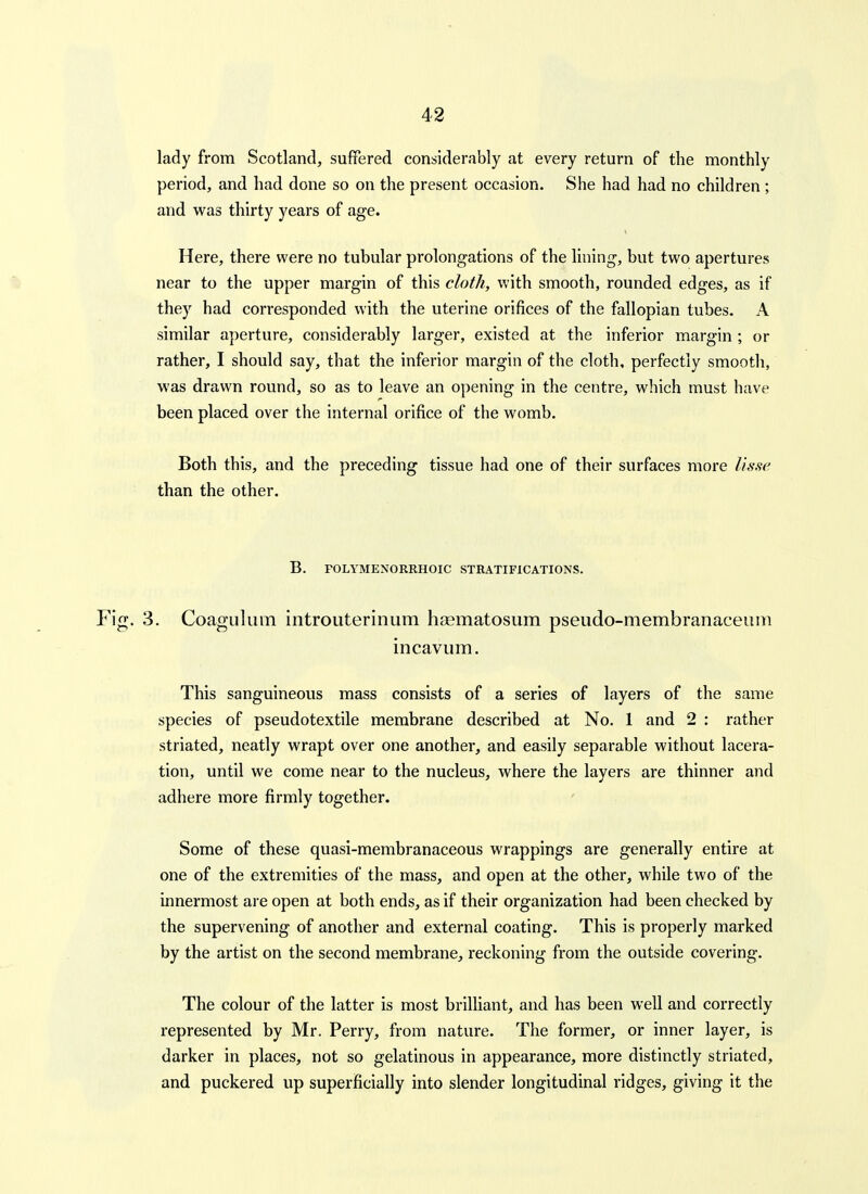 lady from Scotland, suffered considerably at every return of the monthly period, and had done so on the present occasion. She had had no children ; and was thirty years of age. Here, there were no tubular prolongations of the lining, but two apertures near to the upper margin of this cloth, with smooth, rounded edges, as if they had corresponded with the uterine orifices of the fallopian tubes. A similar aperture, considerably larger, existed at the inferior margin ; or rather, I should say, that the inferior margin of the cloth, perfectly smooth, was drawn round, so as to leave an opening in the centre, which must have been placed over the internal orifice of the womb. Both this, and the preceding tissue had one of their surfaces more I'lSfie than the other. B. FOLYMENORRHOIC STRATIFICATIONS. Fig. 3. CoagLilum introuterinum haematosum pseudo-membranaceiini incaviim. This sanguineous mass consists of a series of layers of the same species of pseudotextile membrane described at No. 1 and 2 : rather striated, neatly wrapt over one another, and easily separable without lacera- tion, until we come near to the nucleus, where the layers are thinner and adhere more firmly together. Some of these quasi-membranaceous wrappings are generally entire at one of the extremities of the mass, and open at the other, while two of the innermost are open at both ends, as if their organization had been checked by the supervening of another and external coating. This is properly marked by the artist on the second membrane, reckoning from the outside covering. The colour of the latter is most brilhant, and has been well and correctly represented by Mr. Perry, from nature. The former, or inner layer, is darker in places, not so gelatinous in appearance, more distinctly striated, and puckered up superficially into slender longitudinal ridges, giving it the