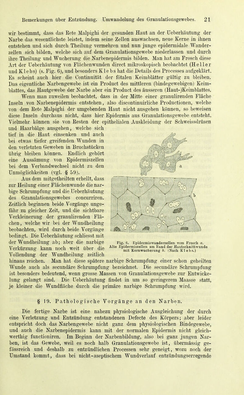 wir bestimmt, class das Eete Malpighi der gesunden Haut an der Ueberhäutung der Narbe das wesentlichste leistet, indem seine Zellen auswachsen, neue Kerne in ihnen entstehen und sich durch Theilung vermehren und nun junge epidermidale Wander- zellen sich bilden, welche sich auf dem Granulationsgewebe niederlassen und durch ihre Theilung und Wucherung die Narbenepidermis bilden. Man hat am Frosch diese Art der Ueberhäutung von Flächenwunden direct milcroskopisch beobachtet (Heller und Klebs) (s. Fig. 6), und besonders K1 ebs hat die Details des Processes aufgeklärt. Es scheint auch hier die Continuität der fötalen Keimblätter gültig zu bleiben. Das eigentliche Narbengewebe ist ein Product des mittleren (bindegewebigen) Keim- blattes, das Hautgewebe der Narbe aber ein Product des äusseren (Haut-)Keimblattes. Wenn man zuweilen beobachtet, dass in der Mitte einer granulirenden Fläche Inseln von Narbenepidermis entstehen, also discontinuirliche Productionen, welche von dem Kete Malpighi der umgebenden Haut nicht ausgehen können, so beweisen diese Inseln durchaus nicht, dass hier Epidermis aus Granulationsgewebe entsteht. Vielmehr können sie von Besten der epithelialen Auskleidung der Schweissdrüsen und Haarbälge ausgehen, welche sich tief in die Haut einsenken und auch bei etwas tiefer greifenden Wunden in den verletzten Geweben in Bruchstücken übrig bleiben können. Endlich gehört eine Aussämuug von Epidermiszeilen bei dem Verbandwechsel nicht zu den Unmöglichkeiten (vgl. § 59). Aus dem mitgetheilten erhellt, dass zur Heilung einer Flächenwunde die nar- bige Schrumpfung und die Ueberhäutung des Granulationsgewebes concurriren. Zeitlich beginnen beide Vorgänge unge- fähr zu gleicher Zeit, und die sichtbare Verkleinerung der granulirenden Flä- chen, welche wir bei der Wundheilung beobachten, wird durch beide Vorgänge bedingt. Die Ueberhäutung schliesst mit der Wundheilung ab; aber die narbige Verkürzung kann noch weit über die Vollendung der Wundheilung zeitlich hinaus reichen. Man hat diese spätere narbige Schrumpfung einer schon geheilten Wunde auch als secundäre Schrumpfung bezeichnet. Die secundäre Schrumpfung ist besonders bedeutend, wenn grosse Massen von Granulationsgewebe zur Entwicke- lung gelangt sind. Die Ueberhäutung findet in um so geringerem Maasse statt, je kleiner die Wundfläche durch die primäre narbige Schrumpfung wird. § 19. Pathologische Vorgänge an den Narben. Die fertige Narbe ist eine nahezu physiologische Ausgleichung der durch eine Verletzung und Entzündung entstandenen Defecte des Körpers; aber leider entspricht doch das Narbengewebe nicht ganz dem physiologischen Bindegewebe, und auch die Narbenepidermis kann mit der normalen Epidermis nicht gleich- werthig functioniren. Im Beginn der Narbenbildung, also bei ganz jungen Nar- ben, ist das Gewebe, weil es noch halb Granulationsgewebe ist, übermässig ge- fässreich und deshalb zu entzündlichen Processen sehr geneigt, wozu noch der Umstand kommt, dass bei nicht-aseptischem Wundverlauf entzündungserregende Fig. 6. EpidevmiswanderzeUen vom Frosch a. Alte Epidermiszellen am Fand der Hautschnittwnnde mit KernwQcherung b. (Nach Klebs.)