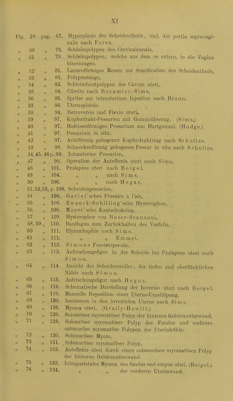 29 . 67. Hyperplasie des Scheidentheils, mcl. der portio supravagi- nal is nach Farre. 30 !) 79. Schleinipolypen des Clervicalcanals. 31 )) 79. Schleimpolypen, welche aus dem os extern, m die Vagina hineinragen. 32 )) 81, Lanzenformiges Messer zur Scarification des Scheidentheils, 33 n 81. Polypenzange. 34 !) 82. SchJeimhautpolypen des Gavuni uteri. 35 n 84. Cürette nach R e c a m i e v - S i m s. 36 85. bpntze zur mtrautennen Injection nach Braun. 37 !) 86. Uteruspistole. 38 » 94. Retroversio und Flexio uteri. 39 )) 97. Ivupierdraht-Pessanen mit Gummiuberzug. (Sims.) 40 ?j 97. Huieisentormiges ressarmm aus Hartgummi. (Hodge.) 41 ;> 97. Pessarium in situ. 42 )) 97. Achtformig gebogener Kupferdrahtring nach Schultze. 43 !) 98. Schneckenförmig gebogenes Pessar in situ nach Schultze. 44,45 , 46p.99. Intrauterine Pessarien. 47 !) 99. Operation der Anteflexio uteri nach Sims. 48 )) 101. Prolapsus uteri nach B e i g e 1. 49 )) 104. „ „ nach S i m s. 50 !) 106. „ „ nach H e g a r. 51,52,53, p. 108. Scbeidenpessarien. 54 n 108. G a r i e r sches Pessaire k l'air. 55 108. Z w a n c k - S c h i 11 i n g' sehe Hysterophor. 56 » 108. Mayer' sehe Kautschukring. 57 109. Hysterophor von R o ser-Sca nzoni. 58, 59 » 110. Bandagen zum Zmaickhalten des Vorfalls. 60 III. Elytrorhapbie nach S i m s. 61 » III. „ „ Emme t. 62 !) 112. S i m 0 n s Fensterspecula. 63 )1 113. Anfrischungsfigiir in der Scheide bei Prolapsus uteri nach S i m 0 n. 64 J) 114. Ansicht des Scbeidenwalles, der tiefen und oberflächlichen Nähte nach S i m o n. 65 n 115. Anfrischungsfigur nach H e g a r. 66 •3 116. Schematische Darstellung der Inversio uteri nach Bei geh 67 1) 119. Manuelle Reposition einer Uterus-Umstülpung. 68 n 120. Incisionen in den invertirten Uterus nach Sims. 69 » 126. Myoma uteri. (Graily-Hewitt.) 70 128. Subseröser myomatöser Polyp der hinteren Gebärmutterwand. 71 )) 128. Subseröser myomatöser Polyp des Fundus und mehrere submucöse myomatöse Polypen der Uterinhöhle. 72 :) 130. Submucöses Myom. 73 )i 131. , , Submucöser myomatöser Polyp. 74 M 132. Anteflexio uteri durch einen submucösen myomatösen Polvp der hinteren Gebärmutterwand. 75 » 133. Intraparietales Myoma des fundus und corpus uteri. (Beigel.) 76 134. )) „ iler vorderen Uterinwand.