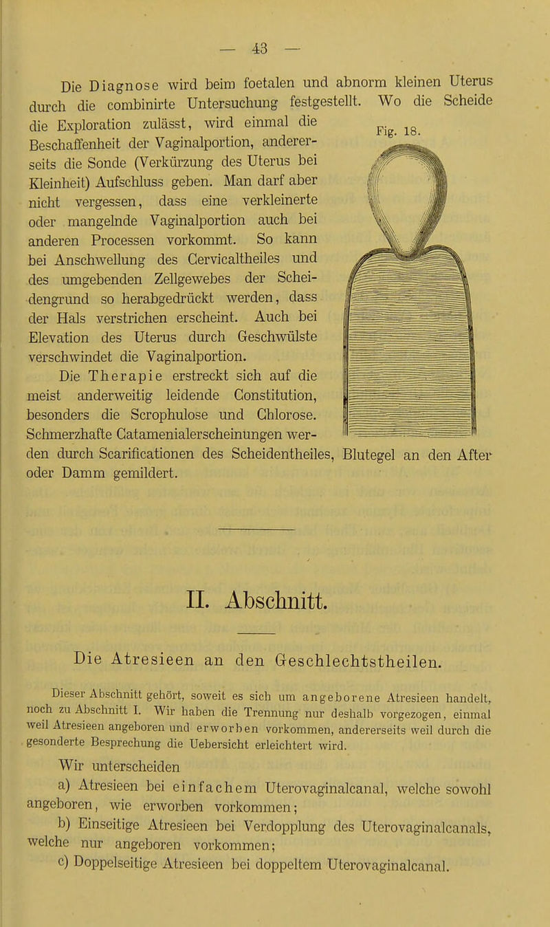 Die Diagnose wird beim foetalen und abnorm kleinen Uterus durch die combinirte Untersuchung festgestellt. Wo die Scheide die Exploration zulässt, wird einmal die Beschaffenheit der Vaginalportion, anderer- seits die Sonde (Verkürzung des Uterus bei Kleinheit) Aufscliluss geben. Man darf aber nicht vergessen, dass eine verkleinerte oder mangelnde Vaginalportion auch bei anderen Processen vorkommt. So kann bei Anschwellung des Cervicaltheiles und des umgebenden Zellgewebes der Schei- dengrund so herabgedrückt werden, dass der Hals verstrichen erscheint. Auch bei Elevation des Uterus durch Geschwülste verschwindet die Vaginalportion. Die Therapie erstreckt sich auf die meist anderweitig leidende Constitution, besonders die Scrophulose und Chlorose. Schmerzhafte Catamenialerscheinungen wer- den durch Scarificationen des Scheidentheiles, Blutegel an den After oder Damm gemildert. II. Abschnitt. Die Atresieen an den Geschlechtstheilen. Dieser Abschnitt gehört, soweit es sich um angeborene Atresieen handelt, noch zu Abschnitt I. Wir haben die Trennung nur deshalb vorgezogen, einmal weil Atresieen angeboren und erworben vorkommen, andererseits weil durch die gesonderte Besprechung die Uebersicht erleichtert wird. Wir unterscheiden a) Atresieen bei einfachem Uterovaginalcanal, welche sowohl angeboren, wie erworben vorkommen; b) Einseitige Atresieen bei Verdopplung des Uterovaginalcanals, welche nur angeboren vorkommen; c) Doppelseitige Atresieen bei doppeltem Uterovaginalcanal.