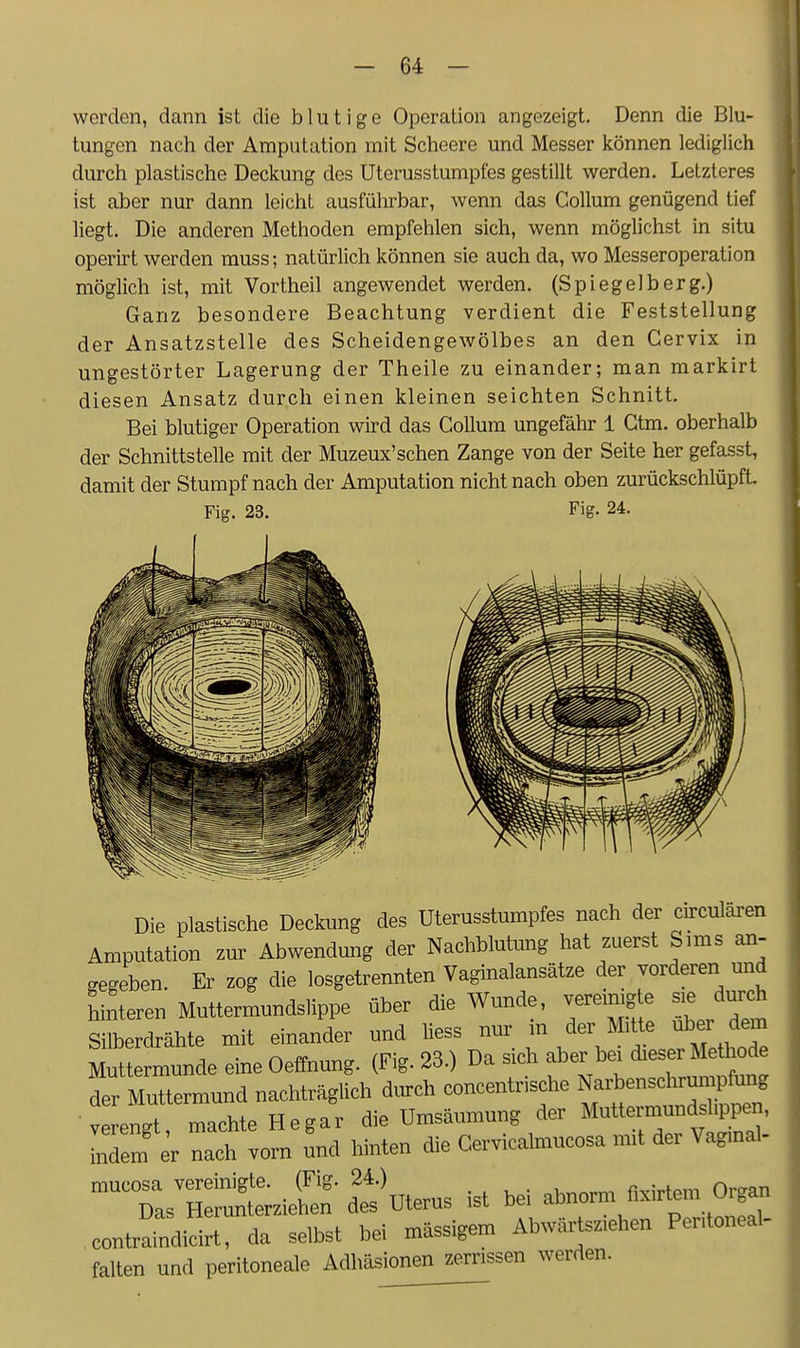 werden, dann ist die blutige Operation angezeigt. Denn die Blu- tungen nach der Amputation mit Scheere und Messer können lediglich durch plastische Deckung des Uterusstumpfes gestillt werden. Letzteres ist aber nur dann leicht ausfülirbar, wenn das Collum genügend tief liegt. Die anderen Methoden empfehlen sich, wenn möglichst in situ operirt werden muss; natürlich können sie auch da, wo Messeroperation möglich ist, mit Vortheil angewendet werden. (Spiegelberg.) Ganz besondere Beachtung verdient die Feststellung der Ansatzstelle des Scheidengewölbes an den Gervix in ungestörter Lagerung der Theile zu einander; man markirt diesen Ansatz durch einen kleinen seichten Schnitt. Bei blutiger Operation wird das Collum ungefähr 1 Gtm. oberhalb der Schnittstelle mit der Muzeux'schen Zange von der Seite her gefasst, damit der Stumpf nach der Amputation nicht nach oben zurückschlüpft. Fig. 23. Fig. 24. Die plastische Deckung des Uterusstumpfes nach der circulären Amputation zur Abwendung der Nachblutung hat zuerst Sims an- gegeben. Er zog die losgetrennten Vaginalansätze der vorderen und hinteren Muttermundslippe über die Wunde, vereinigte sie durch Silberdrähte mit einander und liess nur in der Mitte über dem Mut ermunde eine Oeffnung. (Fig. 23.) Da sich aber bei dieser Methode der Muttermund nachträglich durch concentrische Narbenschruinpfung v engt, machte Hegar die Umsäumung der Muttermundsh^^^^^^^ indem er nach vorn und hinten die Cervicalmucosa mit dei Vagmal- mucosa vereinigte. (Fig. 24.) /;,.;^t«»-. Oraan Das Herunterziehen des Uterus ist be, contraindicirt, da selbst bei massigem Abwarts.iehen Pentoneal falten und peritoneale Adhäsionen zerrissen werden.