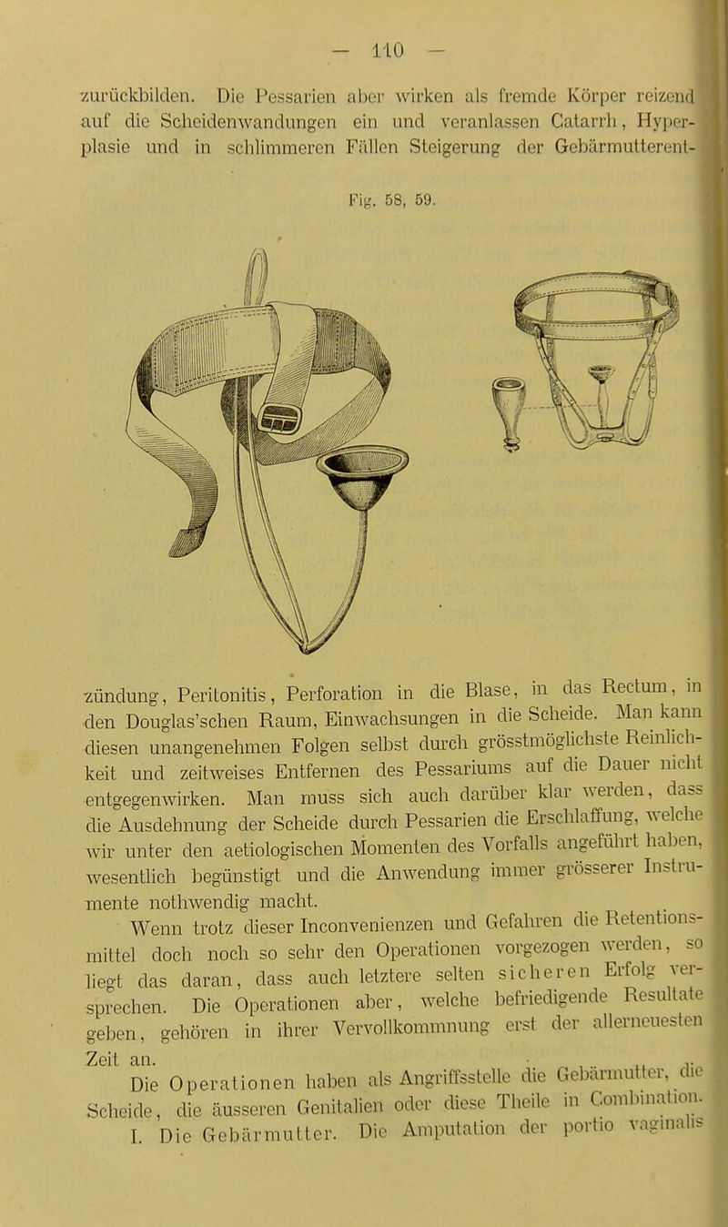 7urückbilden. Die Pessarien aber wirken als fremde Körper reizend auf die Schoidenwandungen ein und veranlassen Catarrh, Hyper- plasie und in schlimmeren Fiillon Steigerung der Gebärmutterent- Fig. 58, 59. 'Zündung, Peritonitis, Perforation in die Blase, in das Rectum, m den Douglas'schen Raum, Einwachsungen in die Scheide. Man kann diesen unangenehmen Folgen selbst durch grösstmöglichste Remlich- keit und zeitweises Entfernen des Pessariums auf die Dauer niclil entgegenwirken. Man muss sich auch darüber klar werden, dass die Ausdehnung der Scheide durch Pessarien die Erschlaffung, welchr wir unter den aetiologischen Momenten des Vorfalls angeführt haben, wesentlich begünstigt und die Anwendung immer grösserer Instru- mente nothwendig macht. Wenn trotz dieser Inconvenienzen und Gefahren die Retentions- raittel doch noch so sehr den Operationen vorgezogen werden, so liegt das daran, class auch letztere selten sicheren Erfolg ver- sprechen. Die Operationen aber, welche befriedigende Resultate geben, gehören in ihrer Vervollkommnung erst der allerneuesten Zeit an. • , r Die Operationen haben als Angriffsstelle die Gebärmutter, die Scheide, die äusseren Genitalien oder diese Theile in Coml^mat.on. I. Die Gebärmutter. Die Amputation der portio vaginal..- I