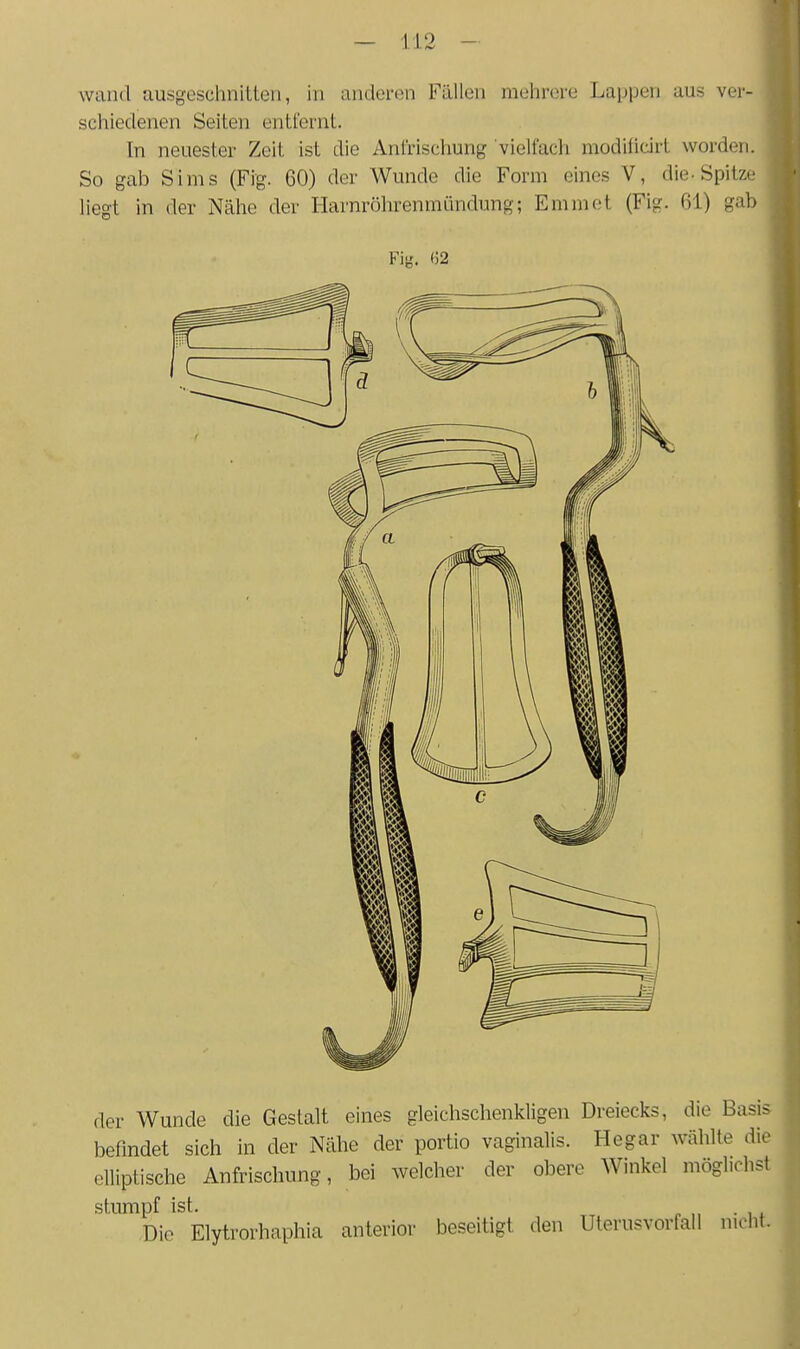 wand uusgeschnilLen, in anderen Fällen mehrere Lappen aus ver- schiedenen Seiten entfernt. In neuester Zeit ist die Anfrischung vielfach modiiicirt worden. So gab Sims (Fig. 60) der Wunde die Form eines V, die-Spitze liegt in der Nähe der Harnrölirenmündung; Emmet (Fig. 61) gab der Wunde die Gestalt eines gleichschenkligen Dreiecks, die Basis befmdet sich in der Nähe der portio vaginalis. Hegar wählte die elliptische Anfrischung, bei welcher der obere Winkel möglichst stumpf ist. Die Elytrorhaphia anterior beseitigt den Uterusvorfall nicht.