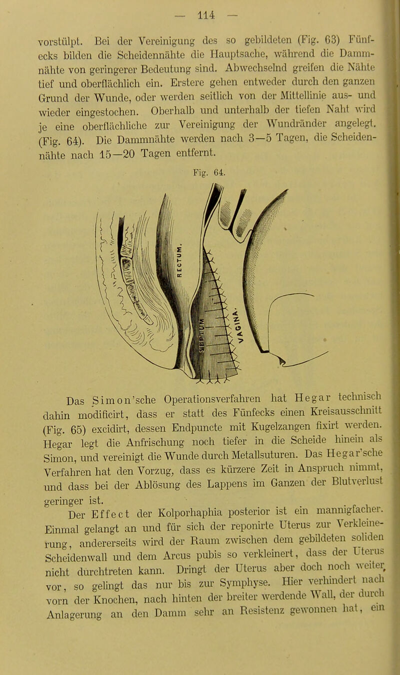 vorstülpt. Bei der Vereinigung des so gebildeten (Fig. 63) Fünf- ecks bilden die Scheidennälite die Hauptsache, während die Damm- nähte von geringerer Bedeutung sind. Abwechselnd greifen die Nähte tief und oberflächlich ein. Erstere gehen entweder durch den ganzen Grund der Wunde, oder werden seitlich von der Mittellinie aus- und wieder eingestochen. Oberhalb und unterhalb der tiefen Naht wird je eine oberflächliche zur Vereinigung der Wundränder angelegt. (Fig. 64). Die Dammnähte werden nach 3—5 Tagen, die Scheiden- nähte nach 15—20 Tagen entfernt. Fiff. 64. Das Simon'sehe Operationsverfahren hat He gar technisch dahin modificirt, dass er statt des Fünfecks einen Kreisausschnitt (Fig. 65) excidirt, dessen Endpuncte mit Kugelzangen fixirt werden. Hegar legt die Anfrischung noch tiefer in die Scheide hinein als Simon, und vereinigt die Wunde durch Metallsuturen. Das Hegar'sche Verfahren hat den Vorzug, dass es kürzere Zeit in Anspruch nimmt, und dass bei der Ablösung des Lappens im Ganzen der Blutverlust geringer ist. . • r i Der Effect der Kolporhaphia posterior ist em mannigfacher. Einmal gelangt an und für sich der reponirte Uterus zm- Verkleine- rung, andererseits wird der Raum zwischen dem gebildeten soliden Scheidenwall und dem Arcus pubis so verkleinert, dass der Uterus nicht durchtreten kann. Dringt der Uterus aber doch noch weiter vor, so gelingt das nur bis zur Symphyse. Hier verhindert nach vorn der Knochen, nach hinten der breiter werdende Wall, der durch Anlagerung an den Damm sehr an Resistenz gewonnen hat, ein