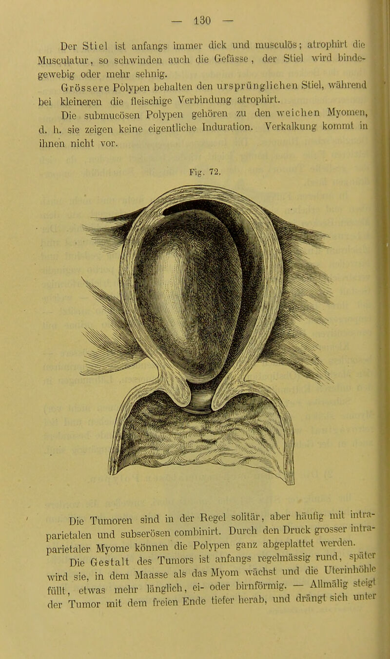 Der Stiel ist anfangs immer dick und rausculös; atrophirt die Musculatur, so schwinden auch die Gefässe, der Stiel wird binde- gewebig oder mehr sehnig. Grössere Polypen behalten den ursprünglichen Stiel, während bei kleineren die fleischige Verbindung atrophirt. Die submucösen Polypen gehören zu den weichen Myomen, d. h. sie zeigen keine eigentliche hiduration. Verkalkung kommt in ihnen nicht vor. Fig. 72. Die Tumoren sind in der Regel solitär, aber häufig mit intra- | parietalen und subserösen combinirt. Durch den Druck grosser intra- | parietaler Myome können die Polypen ganz abgeplattet werden. J Die Gestalt des Tumors ist anfangs regelmässig rund, spater wird sie, in dem Maasse als das Myom wächst und die Utermhohle füllt, etwas mehr länglich, ei- oder birnförmig. - Allmälig ste.gt der Tumor mit dem freien Ende tiefer herab, und drängt sich unter