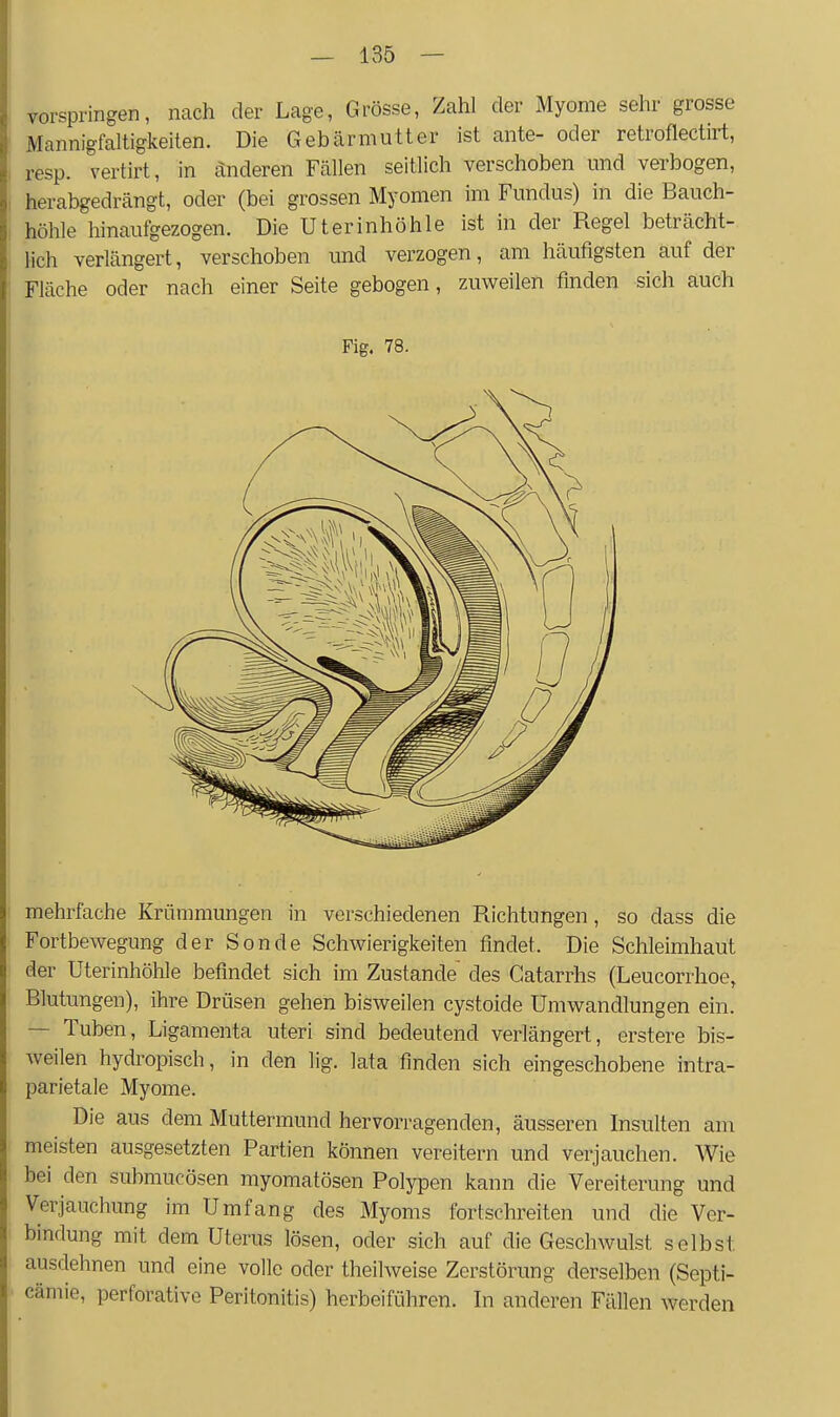 vorspringen, nach der Lage, Grösse, Zahl der Myome sehr grosse Mannigfaltigkeiten. Die Gebärmutter ist ante- oder retroflectirt, resp. vertirt, in änderen Fällen seitlich verschoben und verbogen, herabgedrängt, oder (bei grossen Myomen im Fundus) in die Bauch- höhle hinaufgezogen. Die Uterinhöhle ist in der Regel beträcht- lich verlängert, verschoben und verzogen, am häufigsten auf der Fläche oder nach einer Seite gebogen, zuweilen finden sich auch Fig. 78. mehrfache Krümmungen in verschiedenen Richtungen, so dass die Fortbewegung der Sonde Schwierigkeiten findet. Die Schleimhaut der Uterinhöhle befindet sich im Zustande' des Gatarrhs (Leucorrhoe, Blutungen), ihre Drüsen gehen bisweilen cystoide Umwandlungen ein. — Tuben, Ligamenta uteri sind bedeutend verlängert, erstere bis- Aveilen hydropisch, in den lig. lata finden sich eingeschobene intra- parietale Myome. Die aus dem Muttermund hervorragenden, äusseren Insulten am meisten ausgesetzten Partien können vereitern und verjauchen. Wie bei den submucösen myomatösen Polypen kann die Vereiterung und Verjauchung im Umfang des Myoms fortschreiten und die Ver- bindung mit dem Uterus lösen, oder sich auf die Geschwulst selbst ausdehnen und eine volle oder theilweise Zerstörung derselben (Septi- cämie, perforative Peritonitis) herbeiführen. In anderen Fällen werden