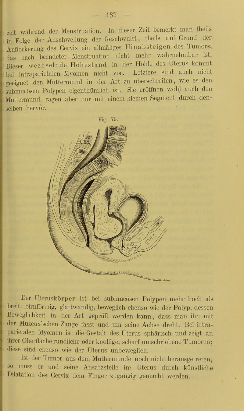 zeit wälu-end der Menstruation. In dieser Zeit bemerlct man theils in Folge der Anschwellung der Geschwulst, theils auf Grund der Auflockerung des Cervix ein allmäliges Hinabsteigen des Tumors, das nach beendeter Menstruation nicht mehr wahrnehmbar ist. Dieser wechselnde Höhestand in der Höhle des Uterus kommt bei intraparietalen Myomen nicht vor. Letztere sind auch nicht geeignet den Muttermund in der Art zu überschreiten, wie es den submucösen Polypen eigenthümlich ist. Sie eröffnen wohl auch den Muttermund, ragen aber nur mit einem kleinen Segment durch den- selben hervor. Fig. 79. Der U.teruskörper ist bei submucösen Polypen mehr hoch als breit, birnförmig, glattwandig, beweglich ebenso wie der Polyp, dessen Beweglichkeit in der Art geprüft werden kann, dass man ihn mit der Muzeux'schen Zange fasst und um seine Achse dreht. Bei intra- parietalen Myomen ist die Gestalt des Uterus sphärisch und zeigt an ihrer Oberfläche rundliche oder knollige, scharf umschriebene Tumoren; diese sind ebenso wie der Uterus unbeweglich. Ist der Tumor aus dem Muttermunde noch nicht herausgetreten, so muss er und seine Ansatzstelle im Uterus durch künstliche Dilatation des Cervix dem Finger zugängig gemacht werden.