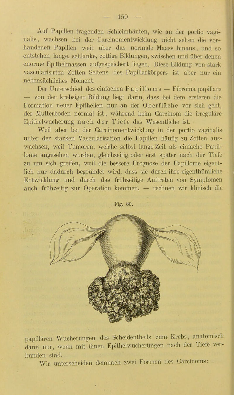 Auf Papillen tragenden Schleimhäuten, wie an der portio vagi- nalis, wachsen bei der Carcinomentwicklung nicht selten die vor- handenen Papillen weit über das normale Maass hinaus, und so entstehen lange, schlanke, zottige Bildungen, zwischen und über denen enorme EpiUielmassen aufgespeichert liegen. Diese Bildung von stark vascularisirten Zotten Seitens des Papillarkörpcrs ist aber nur ein nebensächliches Moment. Der Unterschied des einfachen Papilloms — Fibroma papilläre — von der krebsigen Bildung liegt darin, dass bei dem ersteren die Formation neuer Epithelien nur an der Oberfläche vor sich geht, der Mutterboden normal ist, während beim Garcinom die irreguläre Epithelwucherung nach der Tiefe das Wesentliche ist. Weil aber bei der Garcinomentwicklung in der portio vaginalis unter der starken Vascularisation die Papillen häufig zu Zotten aus- wachsen, weil Tumoren, welche selbst lange Zeit als einfache Papil- lome angesehen wurden, gleichzeitig oder erst später nach der Tiefe zu um sich greifen, weil die bessere Prognose der Papillome eigent- lich nur dadurch begründet wird, dass sie durch ihre eigenthümliche Entwicklung und durch das frühzeitige Auftreten von Symptomen auch frühzeitig zur Operation kommen, — rechnen wir klinisch die Fig. 80. papillären Wucherungen des Scheidentheils zum Krebs, anatomisch dann nur, wenn mit ihnen Epithelwucherüngen nach der Tiefe ver- bunden sind. Wir unterscheiden demnach zwei Formen des Garcinoms: