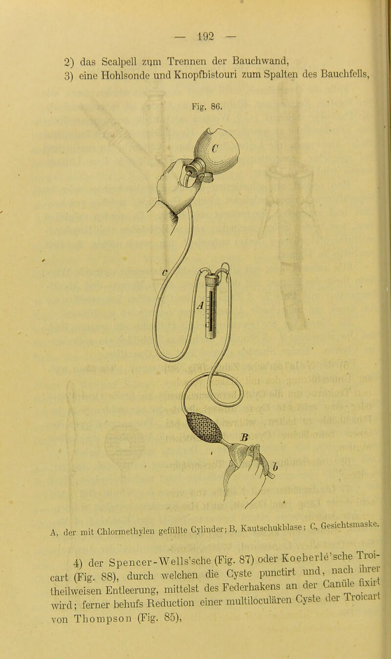 2) das Scalpell 7Aim Trennen der Bauchwand, 3) eine Hohlsonde und Knopfbistouri zum Spalten des Bauchfells, Fig. 86. A, der mit Chlormethylen gefüllte Gylmder;B, Kautschukhlase; C, Gesichtsmaske 4) der Spencer-Wells'sche (Fig. 87) oder Koeberle'sche Troi cart (Fig. 88), durch welchen die Cyste punctirt und, nach ihrer theilweisen Entleerung, mittelst des Federhakens an der Canule üxir wird; ferner behufs Reduction einer multiloculären Cyste der Troicail von Thompson (Fig. 85),